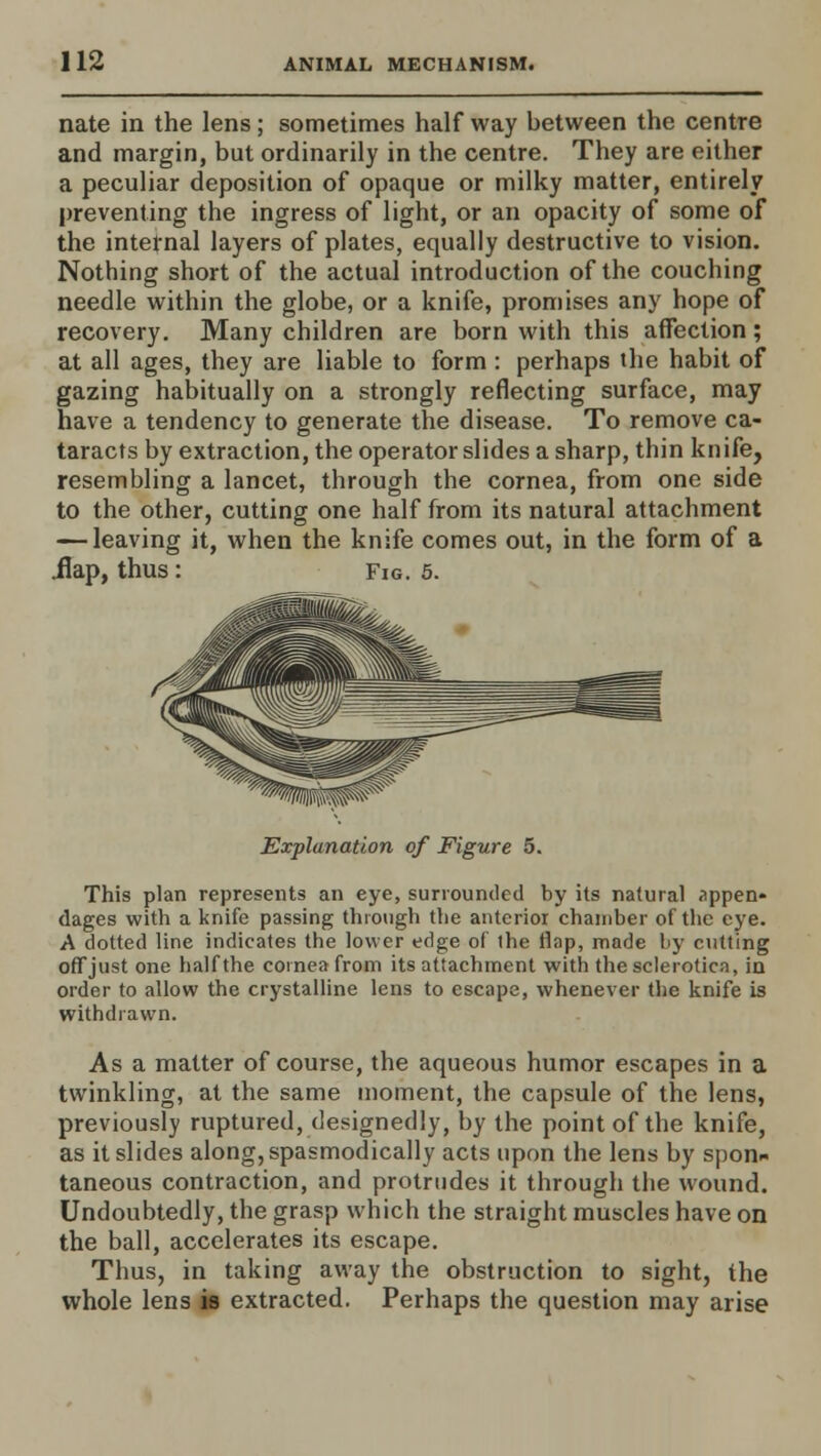 nate in the lens; sometimes half way between the centre and margin, but ordinarily in the centre. They are either a peculiar deposition of opaque or milky matter, entirely preventing the ingress of light, or an opacity of some of the internal layers of plates, equally destructive to vision. Nothing short of the actual introduction of the couching needle within the globe, or a knife, promises any hope of recovery. Many children are born with this affection; at all ages, they are liable to form : perhaps the habit of gazing habitually on a strongly reflecting surface, may have a tendency to generate the disease. To remove ca- taracts by extraction, the operator slides a sharp, thin knife, resembling a lancet, through the cornea, from one side to the other, cutting one half from its natural attachment — leaving it, when the knife comes out, in the form of a .flap, thus : Fig. 5. Explanation of Figure 5. This plan represents an eye, surrounded by its natural appen» dages with a knife passing through the anterior chamber of the eye. A dotted line indicates the lower edge of the flap, made by cutting off just one half the cornea from its attachment with the sclerotica, in order to allow the crystalline lens to escape, whenever the knife is withdrawn. As a matter of course, the aqueous humor escapes in a twinkling, at the same moment, the capsule of the lens, previously ruptured, designedly, by the point of the knife, as it slides along, spasmodically acts upon the lens by spon- taneous contraction, and protrudes it through the wound. Undoubtedly, the grasp which the straight muscles have on the ball, accelerates its escape. Thus, in taking away the obstruction to sight, the whole lens is extracted. Perhaps the question may arise