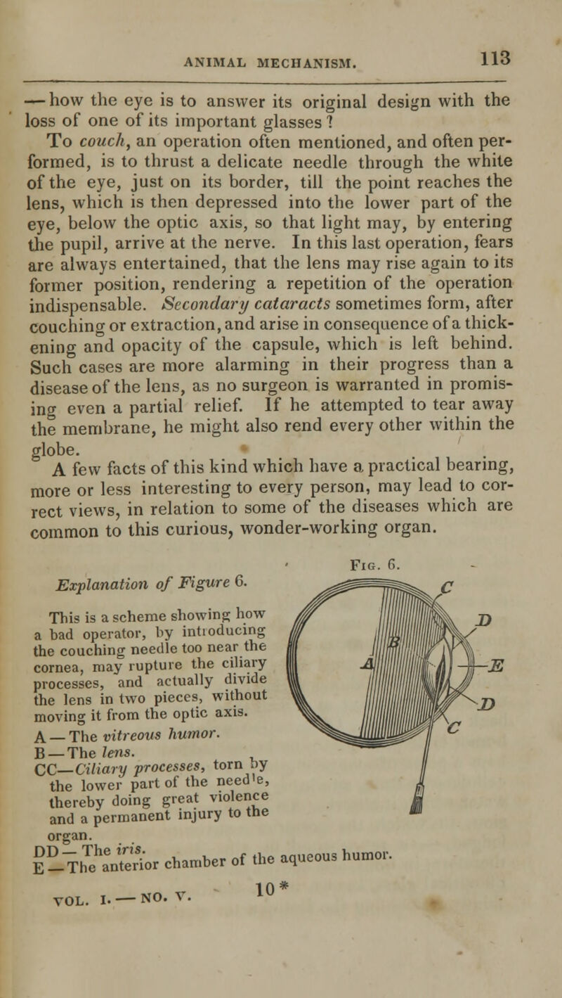 — how the eye is to answer its original design with the loss of one of its important glasses 7 To couch, an operation often mentioned, and often per- formed, is to thrust a delicate needle through the white of the eye, just on its border, till the point reaches the lens, which is then depressed into the lower part of the eye, below the optic axis, so that light may, by entering the pupil, arrive at the nerve. In this last operation, fears are always entertained, that the lens may rise again to its former position, rendering a repetition of the operation indispensable. Secondary cataracts sometimes form, after coucnino- or extraction, and arise in consequence of a thick- ening and opacity of the capsule, which is left behind. Such cases are more alarming in their progress than a disease of the lens, as no surgeon is warranted in promis- ing even a partial relief. If he attempted to tear away the membrane, he might also rend every other within the globe. A few facts of this kind which have a practical bearing, more or less interesting to every person, may lead to cor- rect views, in relation to some of the diseases which are common to this curious, wonder-working organ. Fig. 6. Explanation of Figure 6. This is a scheme showing how a bad operator, by intioducing the couching needle too near the cornea, may rupture the ciliary processes, and actually divide the lens in two pieces, without moving it from the optic axis. A — The vitreous humor. B — The lens. CC—Ciliary processes, torn by the lower part of the need'e, thereby doing great violence and a permanent injury to the organ. E -^hTehaen£or chamber of the aqueous humor. VOL. I. NO. T. 10