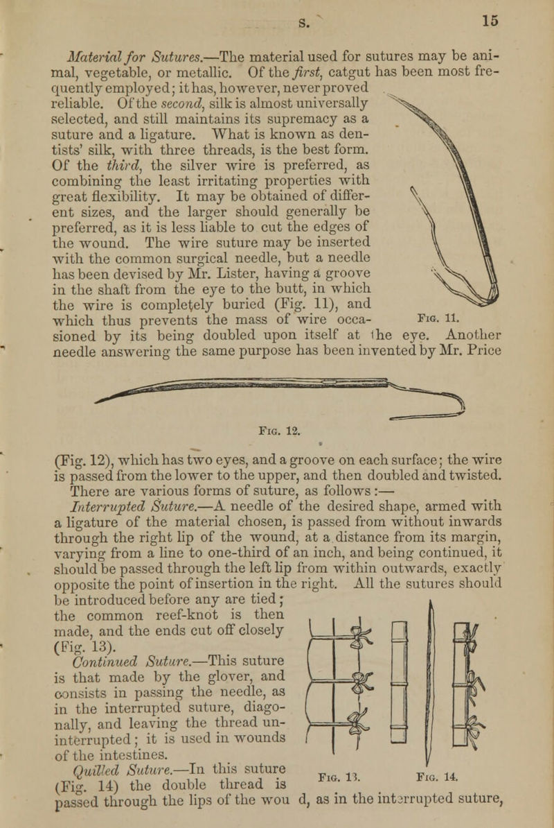Material for Sutures.—The material used for sutures may be ani- mal, vegetable, or metallic. Of the first, catgut has been most fre- quently employed; it has, however, never proved reliable. Of the second, silk is almost universally selected, and still maintains its supremacy as a suture and a ligature. What is known as den- tists' silk, with three threads, is the best form. Of the third, the silver wire is preferred, as combining the least irritating properties with great flexibility. It may be obtained of differ- ent sizes, and the larger should generally be preferred, as it is less liable to cut the edges of the wound. The wire suture may be inserted with the common surgical needle, but a needle has been devised by Mr. Lister, having a groove in the shaft from the eye to the butt, in which the wire is completely buried (Fig. 11), and which thus prevents the mass of wire occa- sioned by its being doubled upon itself at 1he eye. Another needle answering the same purpose has been invented by Mr. Price Fig. 11. Fie. 12. (Fig. 12), which has two eyes, and a groove on each surface; the wire is passed from the lower to the upper, and then doubled and twisted. There are various forms of suture, as follows:— Interrupted Suture.—A needle of the desired shape, armed with a ligature of the material chosen, is passed from without inwards through the right lip of the wound, at a distance from its margin, varying from a line to one-third of an inch, and being continued, it should be passed through the left lip from within outwards, exactly opposite the point of insertion in the right. All the sutures should be introduced before any are tied; the common reef-knot is then made, and the ends cut off closely (Fig. 13). Continued Suture.—This suture is that made by the glover, and consists in passing the needle, as in the interrupted suture, diago- nally, and leaving the thread un- interrupted ; it is used in wounds of the intestines. QuiVed Suture.—In this suture (Fig. 14) the double thread is passed through the lips of the wou d, as in the interrupted suture, Fig. 13. Fig. 14.