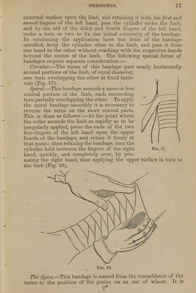 external surface upon the limb, and retaining it with the first and second ringers of the left hand, pass the cylinder under the limb, and by the aid of the third and fourth fingers of the left hand, make a turn or two to fix the initial extremity of the bandage. In continuing the application have but little of the bandage unrolled, keep the cylinder close to the limb, and pass it from one hand to the other without reaching with the respective hands beyond the centre of the limb. The following special forms of bandages require separate consideration:— Circular.—The turns of this bandage pass nearly horizontally around portions of the limb, of equal diameter, one turn overlapping the other at fixed inter- vals (Fig. 17). Spiral.—This bandage ascends a more or less conical portion of the limb, each succeeding turn partially overlapping the other. To apply the spiral bandage smoothly it is necessary to reverse the turns on the more conical parts. This is done as follows:—At the point where the roller ascends the limb so rapidly as to be irregularly applied, press the ends of the two fore-fingers of the left hand upon the upper fourth of the bandage, and retain it firmly at that point; then relaxing the bandage, turn the cylinder held between the fingers of the right hand, quickly, and completely over, by pro- nating the right hand, thus applying the upper surface in turn to the limb (Fig. 18). Fig. 17. Fig. 18. The Spica.—This bandage is named from the resemblance of the turns to the position of the grains on an ear of wheat. It is o*