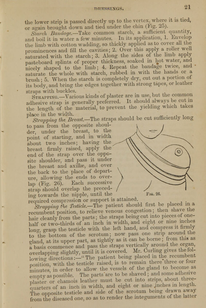 the lower strip is passed directly up to the vertex, where it is tied, or again brought down and tied under the chin (Fig. 25). Starch Bandage.—Take common starch, a sufficient quantity, and boil it in water a few minutes. In its application, 1. Envelop the limb with cotton wadding, so thickly applied as to cover all the prominences and fill the cavities; 2. Over this apply a roller well saturated with the starch; 3. Along the sides of the limb apply pasteboard splints of proper thickness, soaked in hot water, and nicely shaped to the limb; 4. Repeat the bandage twice, and ■ saturate the whole with starch, rubbed in with the hands or a brush; 5. When the starch is completely dry, cut out a portion ot its body, and bring the edges together with strong tapes, or leather straps with buckles. Str u'ping —Various kinds of plaster are in use, but the common adhesive strap is generally preferred. It should always be cut m the length of the material, to prevent the yielding which takes place in the width. . . . Strapping the Breast—The straps should be cut sufficiently long to pass from the opposite shoul- der, under the breast, to the point of starting, and in width about two inches; having the breast firmly raised, apply the end of the strap over the oppo- site shoulder, and pass it under the breast and axillae, and over the back to the place of depart- ure, allowing the ends to over- lap (Fig. 26). Each successive strap should overlap the preced- ing towards the nipple, until the Fio. required compression or support is attained. , , ■ Strapping the Testicle.—The patient should first be placed in a recumbent position, to relieve venous congestion; then shave the hair cleanly from the parts; the straps being cut into pieces of one- half or two-thirds of an inch in width, and eight or nine inches Ion- grasp the testicle with the left hand, and compress it firmly to the bottom of the scrotum; now pass one strip around the Mand, at its upper part, as tightly as it can be borne; from this as a basis commence and pass the straps vertically around the organ, overlapping slightly, until it is covered. Mr. Curling gives the fol- lowing directions:—The patient being placed m the recumbent position, with the testicle raised, is to remain there three or four minutes in order to allow the vessels of the gland to become as empty as possible. The parts are to be shaved ; and some adhesive nlaster or chamois leather must be cut into strips, about three- auarters of an inch in width, and eight or nine .inches in length. The opposite testicle and side of the scrotum being drawn away from the diseased one, so as to render the integuments of the latter