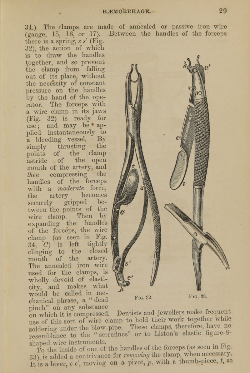 34.) The clamps are made of annealed or passive iron wire (gauge, 15, 16, or 17). Between the handles of the forceps there is a spring, s s' (Fig. 32), the action of which is to draw the handles together, and so prevent the clamp from falling out of its place, without the necessity of constant pressure on the handles by the hand of the ope- rator. The forceps with a wire clamp in its jaws (Fig. 32) is ready for use ; and may be • ap- plied instantaneously to a bleeding vessel. By simply thrusting the points of the clamp astride of the open mouth of the artery, and then compressing the handles of the forceps with a moderate force, the artery becomes securely gripped be- tween the points of the wire clamp. Then by expanding the handles of the forceps, the wire clamp (as seen in Fig. 34, 0) is left tightly clinging to the closed mouth of the artery. The annealed iron wire used for the clamps, is wholly devoid of elasti- city, and makes what would be called in me- chanical phrase, a  dead pinch on any substance on which it is compressed. Dentists and jewellers make frequent use of this sort of wire clamp to hold their work together while soldering under the blow-pipe. These clamps, therefore, have no resemblance to the serrefines or to Liston's elastic figure-8- shaped wire instruments. . To the inside of one of the handles of the forceps (as seen in big. 33) is added a contrivance for removing the clamp, when necessary It is a lever, c c', moving on a pivot, p, with a thumb-piece, t, at Fio. 33.