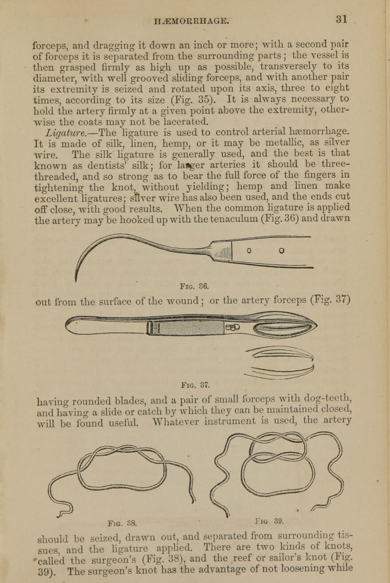 forceps, and dragging it down an inch or more; with a second pair of forceps it is separated from the surrounding parts; the vessel is then grasped firmly as high up as possible, transversely to its diameter, with well grooved sliding forceps, and with another pair its extremity is seized and rotated upon its axis, three to eight times, according to its size (Fig. 35). It is always necessary to hold the artery firmly at a given point above the extremity, other- wise the coats may not be lacerated. Ligature.—The ligature is used to control arterial haemorrhage. It is made of silk, linen, hemp, or it may be metallic, as silver wire. The silk ligature is generally used, and the best is that known as dentists' silk; for laiger arteries it should be three- threaded, and so strong as to bear the full force of the fingers in tightening the knot, without yielding; hemp and linen make excellent ligatures; silver wire has also been used, and theends cut off close, with good results. When the common ligature is applied the artery may be hooked up with the tenaculum (Fig. 36) and drawn Fio. 86. out from the surface of the wound; or the artery forceps (Fig. 37) Fig. 37. having rounded blades, and a pair of small forceps with dog-teeth, and having a slide or catch by which they can be maintained closed, will be found useful. Whatever instrument is used, the artery Fig. 88. should be seized, drawn out, and separated from surrounding tis- sues and the ligature applied. There are two kinds of knots, 'called the surgeon's (Fig. 38), and the reef or sailor's knot (Fig. 39). The surgeon's knot has the advantage of not loosening while