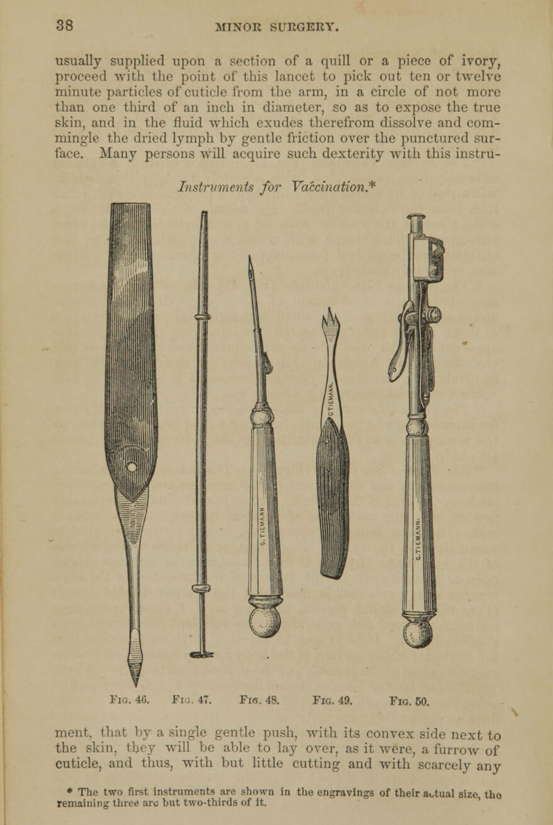 usually supplied upon a section of a quill or a piece of ivory, proceed with the point of this lancet to pick out ten or twelve minute particles of cuticle from the arm, in a circle of not more than one third of an inch in diameter, so as to expose the true skin, and in the fluid which exudes therefrom dissolve and com- mingle the dried lymph by gentle friction over the punctured sur- face. Many persons will acquire such dexterity with this instru- Instrurnents for Vaccination* Fig. 4G. Fiq. 47. Fie. 48. Fig. 49. Fig. 50. ment, that by a single gentle push, with its convex side next to the skin, they will be able to lay over, as it were, a furrow of cuticle, and thus, with but little cutting and with scarcely any * The two first instruments are shown in the engravings of their actual size tho remaining three arc but two-thirds of it.
