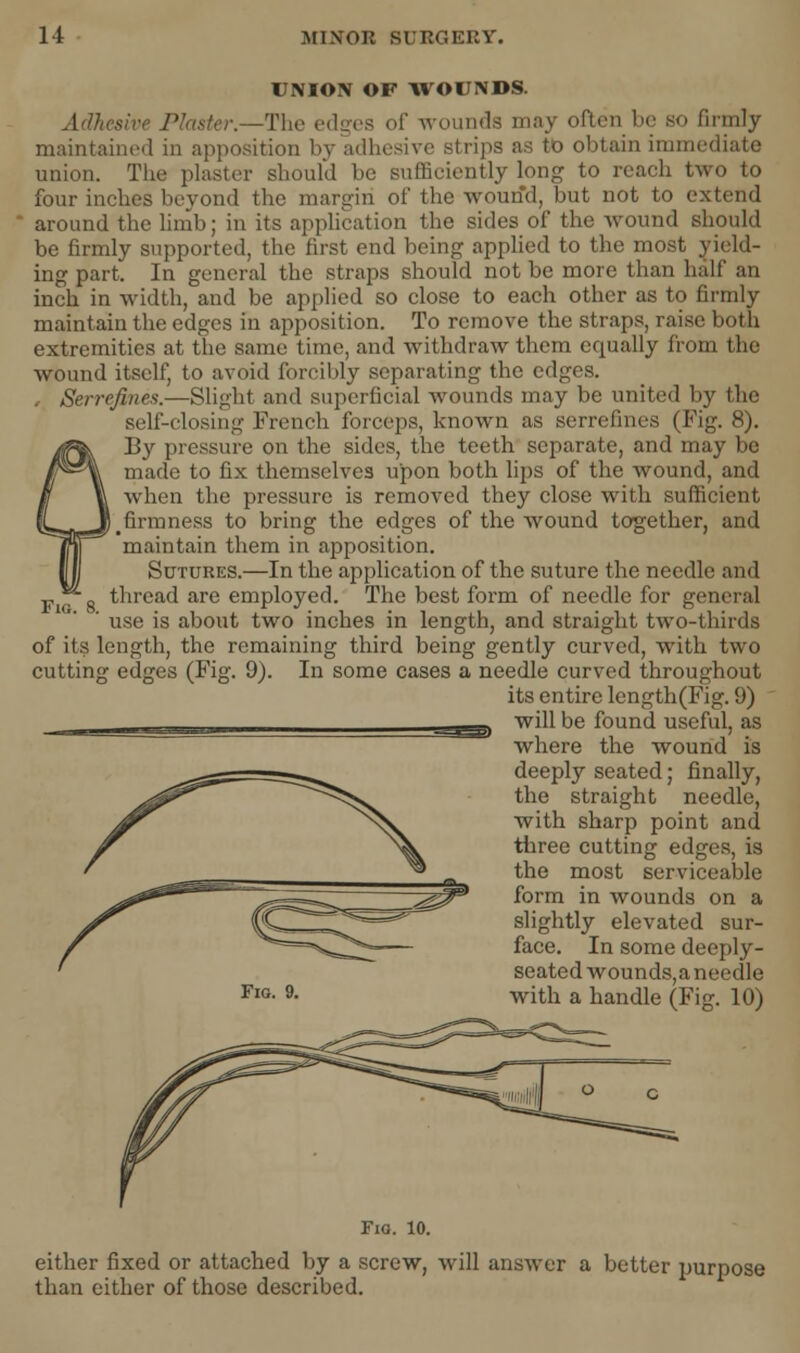 UNION OF WOUNDS. Ad) ister.—The edges of wounda may often be bo firmly maintained in apposition by adhesive strips as to obtain immediate union. The plaster should be sufficiently long to reach two to four inches beyond the margin of the wound, but not to extend around the limb; in its application the sides of the wound should be firmly supported, the first end being applied to the most yield- ing part. In general the straps should not be more than half an inch in width, and be applied so close to each other as to firmly maintain the edges in apposition. To remove the straps, raise both extremities at the same time, and withdraw them equally from the wound itself, to avoid forcibly separating the edges. , Serrefines.—Slight and superficial wounds may be united by the self-closing French forceps, known as serrefines (Fig. 8). By pressure on the sides, the teeth separate, and may be made to fix themselves upon both lips of the wound, and when the pressure is removed they close with sufficient # firmness to bring the edges of the wound together, and maintain them in apposition. Sutures.—In the application of the suture the needle and thread are employed. The best form of needle for general use is about two inches in length, and straight two-thirds of its length, the remaining third being gently curved, with two cutting edges (Fig. 9). In some cases a needle curved throughout its entire length(Fig. 9) will be found useful, as where the wound is deeply seated; finally, the straight needle, with sharp point and three cutting edges, is the most serviceable form in wounds on a slightly elevated sur- face. In some deeply- seated wounds,a needle with a handle (Fig. 10) Fig. 9. either fixed or attached by a screw, will answer a better purpose than either of those described.