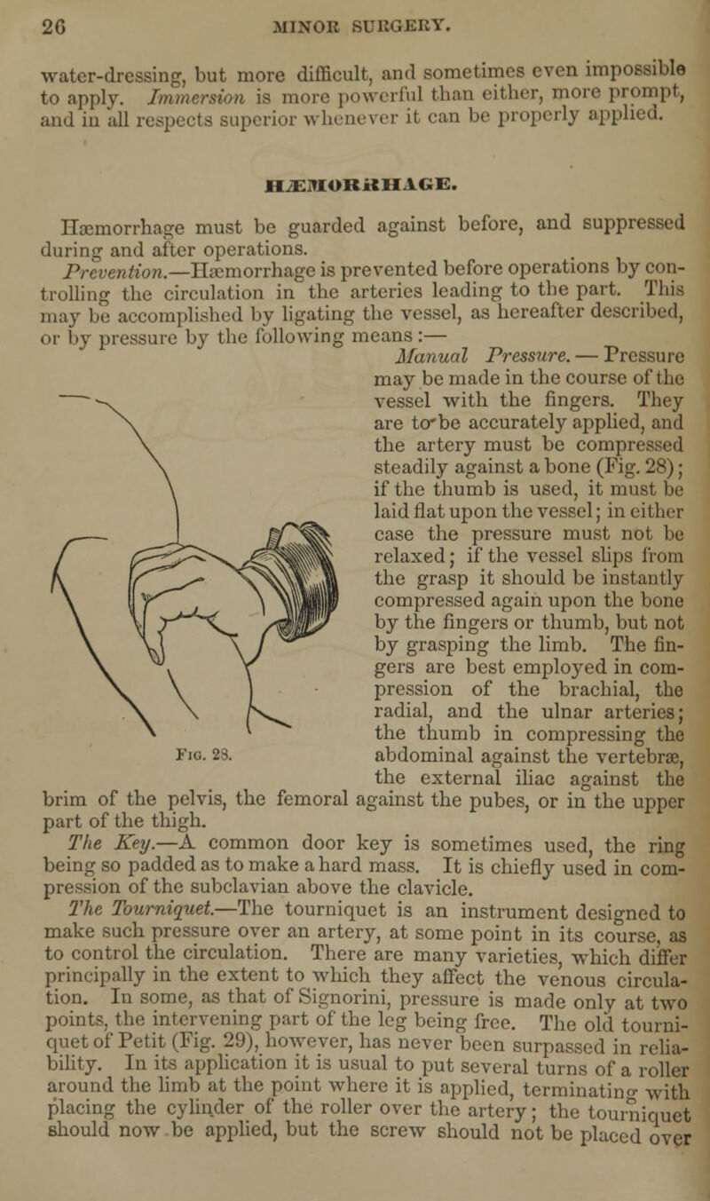 water-dressing, but more difficult, and sometimes even impossible to apply. Immersion is more powerful than cither, more prompt, and in all respects superior whenever it can be properly appli HJEMORKH1GE. Haemorrhage must be guarded against before, and suppressed during and after operations. Prevention.—Hemorrhage is prevented before operations by con- trolling the circulation in the arteries leading to the part. This may be accomplished by ligating the vessel, as hereafter described, or by pressure by the following means:— Manual Pressure. — Pressure may be made in the course of the vessel with the fingers. They are to* be accurately applied, and the artery must be compressed steadily against a bone (Fig. 28); if the thumb is used, it must be laid flat upon the vessel; in either case the pressure must not be relaxed; if the vessel slips from the grasp it should be instantly compressed again upon the bone by the fingers or thumb, but not by grasping the limb. The fin- gers are best employed in com- pression of the brachial, the radial, and the ulnar arteries; the thumb in compressing the Fig. 23. abdominal against the vertebra?, the external iliac against the brim of the pelvis, the femoral against the pubes, or in the upper part of the thigh. The Key.—A common door key is sometimes used, the ring being so padded as to make a hard mass. It is chiefly used in com- pression of the subclavian above the clavicle. The Tourniquet.—The tourniquet is an instrument designed to make such pressure over an artery, at some point in its course, as to control the circulation. There are many varieties, which differ principally in the extent to which they affect the venous circula- tion. In some, as that of Signorini, pressure is made only at two points, the intervening part of the leg being free. The old tourni- quet of Petit (Fig. 29), however, has never been surpassed in relia- bility. In its application it is usual to put several turns of a roller around the limb at the point where it is applied, terminating with placing the cylinder of the roller over the artery; the tourniquet should now be applied, but the screw should not be placed over