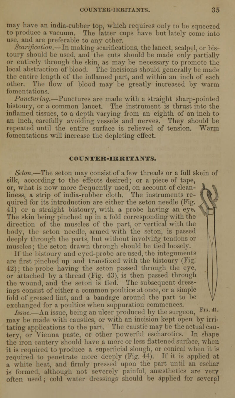 may have an india-rubber top, which requires only to be squeezed to produce a vacuum. The latter cups have but lately come into use, and are preferable to any other. Scarification.—In making scarifications, the lancet, scalpel, or bis- toury should be used, and the cuts should be made only partially or entirely through the skin, as may be necessary to promote the local abstraction of blood. The incisions should generally be made the entire Length of the inflamed part, and within an inch of each other. The How of blood may be greatly increased by warm fomentations. Puncturing.—Punctures are made with a straight sharp-pointed bistoury, or a common lancet. The instrument is thrust into the inflamed tissues, to a depth varying from an eighth of an inch to an inch, carefully avoiding vessels and nerves. They should be repeated until the entire surface is relieved of tension. Warm fomentations will increase the depleting effect. COUNTER-IRRITANTS. Sdon.—The seton may consist of a few threads or a full skein of silk, according to the effects desired; or a piece of tape, or, what is now more frequently used, on account of clean- liness, a strip of india-rubber cloth. The instruments re- quired for its introduction are either the seton needle (Fig. 41) or a straight bistoury, with a probe having an eye. The skin being pinched up in a fold corresponding with the direction of the muscles of the part, or vertical with the body, the seton needle, armed with the seton, is passed deeply through the parts, but without involvhig tendons or muscles; the seton drawn through should be tied loosely. If the bistoury and eyed-probc are used, the integuments are first pinched up and transfixed with the bistoury (Fig. 42); the probe having the seton passed through the eye, or attached by a thread (Fig. 43), is then passed through the wound, and the seton is tied. The subsequent dress- ings consist of either a common poultice at once, or a simple fold of greased lint, and a bandage around the part to be exchanged for a poultice when suppuration commences. Issue.—An issue, being an ulcer produced by the surgeon, Fl'!- 41- may be made with caustics, or with an incision kept open by irri- tating applications to the part. The caustic may be the actual cau- tery, or Vienna paste, or other powerful escharotics. In shape the iron cautery should have a more or less flattened surface, when it is required to produce a superficial slough, or conical when it is required to penetrate more deeply (Fig. If). If it is applied at a white heat, and firmly pressed upon the part until an eschar is formed, although not severely painful, anaesthetics are very often used; cold water dressings should be applied for several