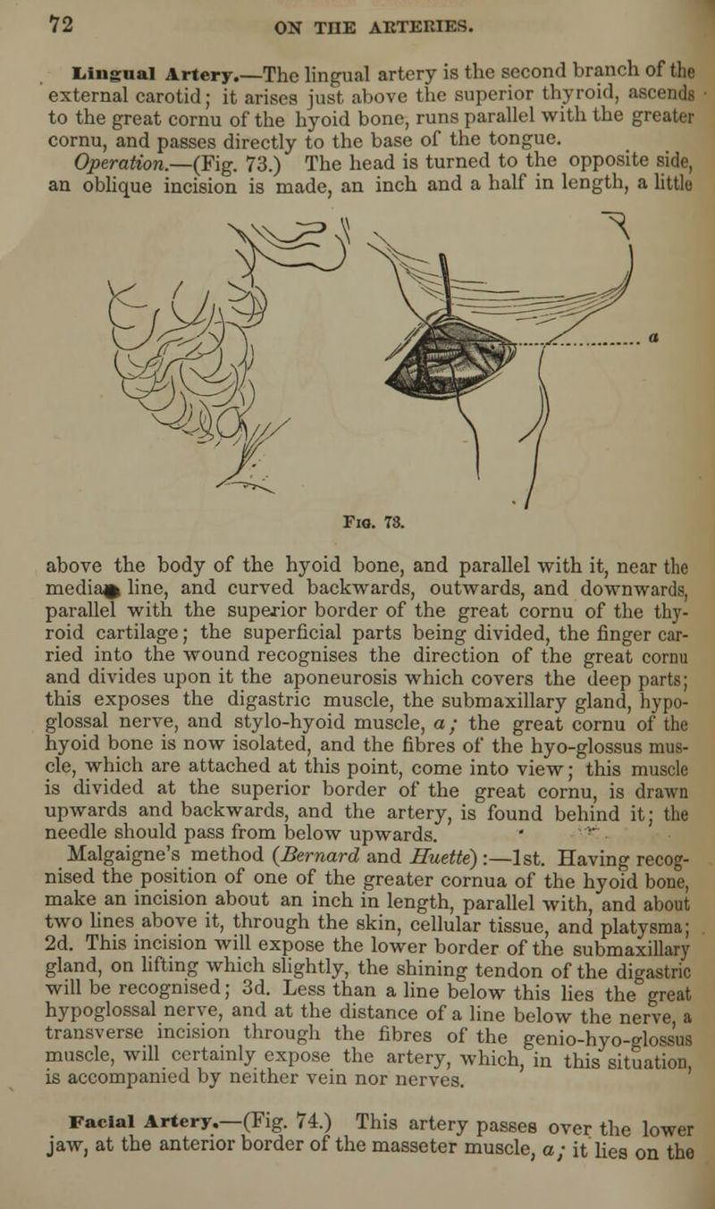 Lingual Artery.—The lingual artery is the second branch of the external carotid; it arises just above the superior thyroid, ascends to the great cornu of the hyoid bone, runs parallel with the greater cornu, and passes directly to the base of the tongue. Operation.—(Fig. 73.) The head is turned to the opposite side, an oblique incision is made, an inch and a half in length, a little Fio. 73. above the body of the hyoid bone, and parallel with it, near the media^ line, and curved backwards, outwards, and downwards, parallel with the superior border of the great cornu of the thy- roid cartilage; the superficial parts being divided, the finger car- ried into the wound recognises the direction of the great cornu and divides upon it the aponeurosis which covers the deep parts; this exposes the digastric muscle, the submaxillary gland, hypo- glossal nerve, and stylo-hyoid muscle, a; the great cornu of the hyoid bone is now isolated, and the fibres of the hyo-glossus mus- cle, which are attached at this point, come into view; this muscle is divided at the superior border of the great cornu, is drawn upwards and backwards, and the artery, is found behind it; the needle should pass from below upwards. ' '• Malgaigne's method {Bernard and Huette) :—1st. Having recog- nised the position of one of the greater cornua of the hyoid bone, make an incision about an inch in length, parallel with, and about two fines above it, through the skin, cellular tissue, and platysma; 2d. This incision will expose the lower border of the submaxillary gland, on lifting which slightly, the shining tendon of the digastric will be recognised; 3d. Less than a line below this lies the great hypoglossal nerve, and at the distance of a line below the nerve, a transverse incision through the fibres of the genio-hyo-glossus muscle, will certainly expose the artery, which, in this situation, is accompanied by neither vein nor nerves. Facial Artery.—(Pig. 74.) This artery passes over the lower jaw, at the anterior border of the masseter muscle, a; it lies on the