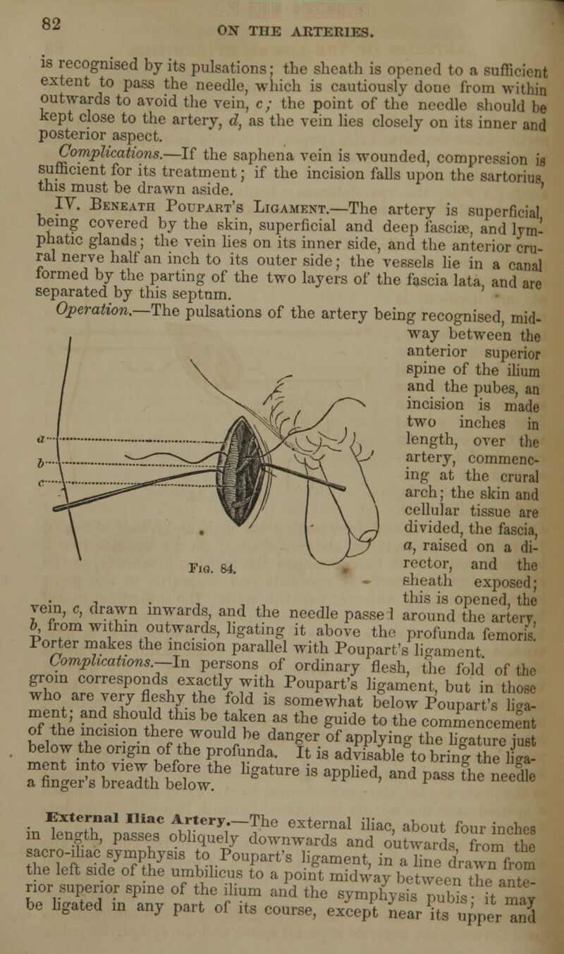 02* THE AKTERIES. is recognised by its pulsations; the sheath is opened to a sufficient extent to pass the needle, which is cautiously done from as outwards to avoid the vein, c; the point of the needle should be kept close to the artery, d, as the vein lies closely on its inner and posterior aspect. Complications.—If the saphena vein is wounded, compression is sufficient for its treatment; if the incision falls upon the sartorius this must be drawn aside. IV. Beneath Potjpart's Ligament.—The artery is superficial being covered by the skin, superficial and deep fascia, and lym- phatic glands; the vein lies on its inner side, and the anterior cru- ral nerve half an inch to its outer side; the vessels lie in a canal formed by the parting of the two layers of the fascia lata, and are separated by this septum. Operation.—The pulsations of the artery being recognised, mid- way between the anterior superior spine of the ilium f and the pubes, an ^f /~~~^ incision is made \£cL^y *wo inches in ■J) length, over the 6...I •^::::^^^^^^rK^vii( \ artei7> commenc- „...! -■•s**'3- msSIf r^ \ inff at the crural A^af^^ wmall I V* \ ai'ch; the skin and cellular tissue are divided, the fascia, a, raised on a di- ns. 84. rector, and the sheath exposed; .„ „ , . , , , this is opened, the vein, c, drawn inwards, and the needle passed around the artery h from within outwards, ligating it above the profunda femoris! Porter makes the incision parallel with Poupart's ligament Complications.—In persons of ordinary flesh, the fold of the groin corresponds exactly with Poupart's ligament, but in those who are very fleshy the fold is somewhat below Poupart's l£ oTtle ESfirS tlUS ^ i^en f the ^Uid6 t0 the commencement of the incision there would be danger of applying the lieature innt below the origin of the profunda. It is advTsable^ori/gZlt i^P^o^^ sacro-ihac symphysis to Poupart's ligament, in a line dVawTfrom the left side of the umbilicus to a point midway between the antS nor superior spine of the ilium and the symphysis puWs- it maV be bgated in any part of its course, except Lar its upper anl