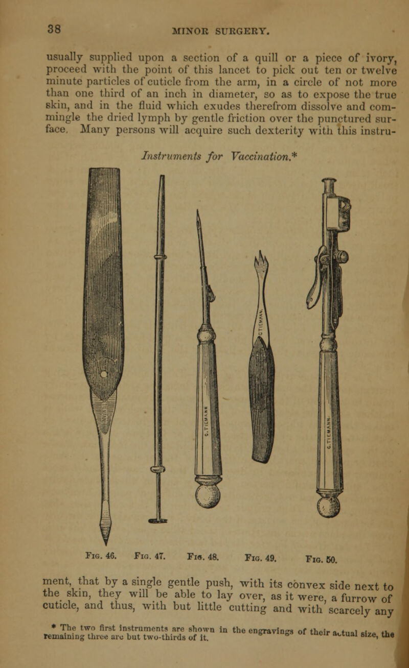 usually supplied upon a section of a quill or a piece of ivory, proceed with the point of this lancet to pick out ten or twelve minute particles of cuticle from the arm, in a circle of not more than one third of an inch in diameter, so as to expose the true skin, and in the fluid which exudes therefrom dissolve and com- mingle the dried lymph by gentle friction over the punctured sur- face. Many persons will acquire such dexterity with this instru- Instruments for Vaccination* Fig. 46. Fig. 47. Fia. 48. Fig. 49. Fio. 60. ment that by a single gentle push, with its convex side next to the skin, they will be able to lay over, as it were, a furrow of cuticle, and thus, with but little cutting and with scarcely any * The two first instruments are shown in the en<ravini of th»,v . * i . a. remaining three arc but two-thirds of it. <-ngravm0s of their actual size, the