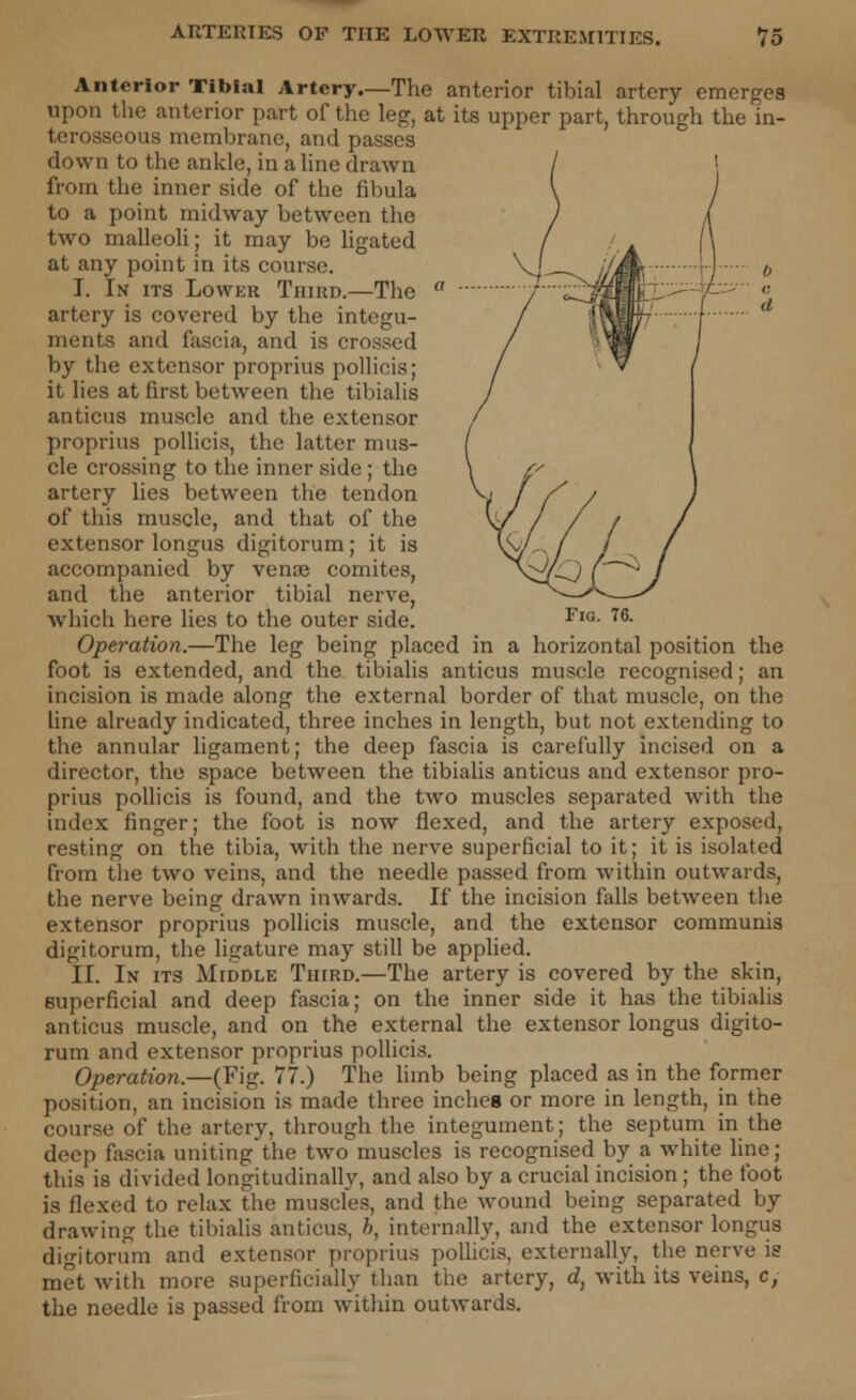 Fig. 76. Anterior Tibial Artery.—The anterior tibial artery emerges upon the anterior part of the leg, at its upper part, through the in- terosseous membrane, and passes down to the ankle, in aline drawn from the inner side of the fibula to a point midway between the two malleoli; it may be ligated at any point in its course. I. In its Lower Third.—The artery is covered by the integu- ments and fascia, and is crossed by the extensor proprius pollicis; it lies at first between the tibialis anticus muscle and the extensor proprius pollicis, the latter mus- cle crossing to the inner side; the artery lies between the tendon of this muscle, and that of the extensor longus digitorum; it is accompanied by venae comites, and the anterior tibial nerve, which here lies to the outer side. Operation.—The leg being placed in a horizontal position the foot is extended, and the tibialis anticus muscle recognised; an incision is made along the external border of that muscle, on the line already indicated, three inches in length, but not extending to the annular ligament; the deep fascia is carefully incised on a director, the space between the tibialis anticus and extensor pro- prius pollicis is found, and the two muscles separated with the index finger; the foot is now flexed, and the artery exposed, resting on the tibia, with the nerve superficial to it; it is isolated from the two veins, and the needle passed from within outwards, the nerve being drawn inwards. If the incision falls between the extensor proprius pollicis muscle, and the extensor communis digitorum, the ligature may still be applied. II. In its Middle Third.—The artery is covered by the skin, superficial and deep fascia; on the inner side it has the tibialis anticus muscle, and on the external the extensor longus digito- rum and extensor proprius pollicis. Operation.—(Fig. 77.) The limb being placed as in the former position, an incision is made three incheg or more in length, in the course of the artery, through the integument; the septum in the deep fascia uniting the two muscles is recognised by a white line; this is divided longitudinally, and also by a crucial incision ; the foot is flexed to relax the muscles, and the wound being separated by drawing the tibialis anticus, b, internally, and the extensor longus digitorum and extensor proprius polhcis, externally, the nerve is met with more superficially than the artery, d, with its veins, c, the needle is passed from within outwards.