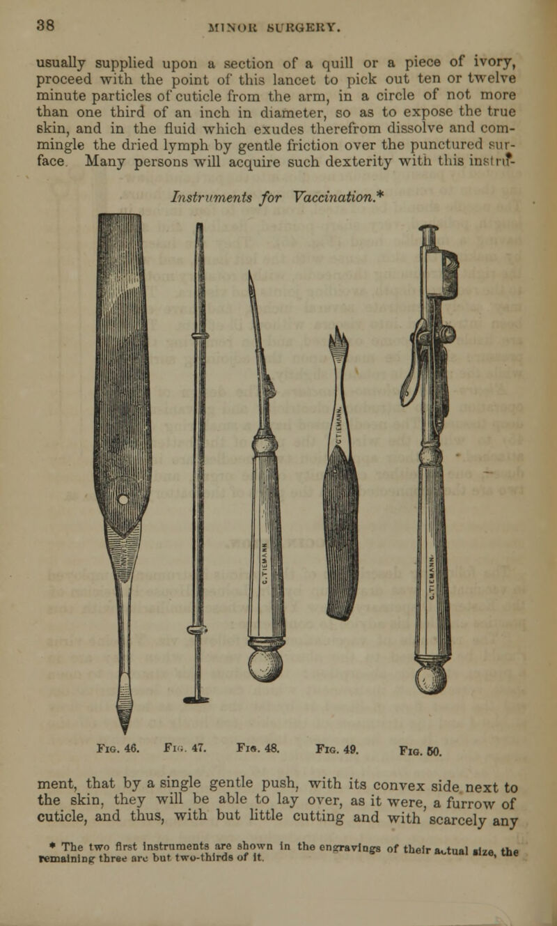 usually supplied upon a section of a quill or a piece of ivory, proceed with the point of this lancet to pick out ten or twelve minute particles of cuticle from the arm, in a circle of not more than one third of an inch in diameter, so as to expose the true skin, and in the fluid which exudes therefrom dissolve and com- mingle the dried lymph by gentle friction over the punctured sur- face Many persons will acquire such dexterity with this instru*- Instruments for Vaccination* Fig. 46. Fig. 47. Fi«. 48. Fig. 49. Fig. 60. ment, that by a single gentle push, with its convex side next to the skin, they will be able to lay over, as it were, a furrow of cuticle, and thus, with but little cutting and with scarcely any ♦ The two first instruments are shown In the ensjravines of their a. timl .<™ tho remaining- three arc hut two-thirds of it. 6 **-l,xal ,ue' lne