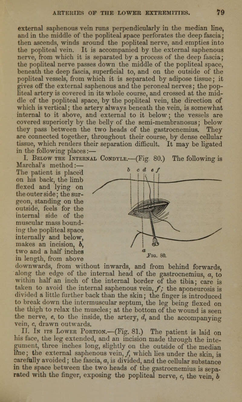 external saphenous vein runs perpendicularly in the median line, and in the middle of the popliteal space perforates the deep fascia; then ascends, winds around the popliteal nerve, and empties into the popliteal vein. It is accompanied by the external saphenous nerve, from which it is separated by a process of the deep fascia ; the popliteal nerve passes down the middle of the popliteal space, beneath the deep fascia, superficial to, and on the outside of the popliteal vessels, from which it is separated by adipose tissue; it gives off the external saphenous and the peroneal nerves; the pop- liteal artery is covered in its whole course, and crossed at the mid- dle of the popliteal space, by the popliteal vein, the direction of which is vertical; the artery always beneath the vein, is somewhat internal to it above, and external to it below; the vessels are covered superiorly by the belly of the semi-membranosus; below they pass between the two heads of the gastrocnemius. They are connected together, throughout their course, by dense cellular tissue, which renders their separation difficult. It may be ligated in the following places:— I. Below the Internal Condyle.—(Fig. 80.) The following is Marchal's method:— The patient is placed on his back, the limb flexed and lying on the outer side; the sur- geon, standing on the outside, feels for the internal side of the muscular mass bound- ing the popliteal space internally and below, makes an incision, b, two and a half inches in length, from above downwards, from without inwards, and from behind forwards, along the edge of the internal head of the gastrocnemius, a, to within half an inch of the internal border of the tibia; care is taken to avoid the internal saphenous vein, f; the aponeurosis is divided a little further back than the skin; the finger is introduced to break down the intermuscular septum, the leg being flexed on the thigh to relax the muscles; at the bottom of the wound is seen the nerve, e, to the inside, the artery, d, and the accompanying vein, c, drawn outwards. IT. In its Lower Portion.—(Fig. 81.) The patient is laid on his face, the leg extended, and an incision made through the inte- gument, three inches long, slightly on the outside of the median lfne; the external saphenous vein, /, which lies under the skin is carefully avoided; the fascia, a, is divided, and the cellular substance in the space between the two heads of the gastrocnemius is sepa- rated with the finger, exposing the popliteal nerve, c, the vein, b