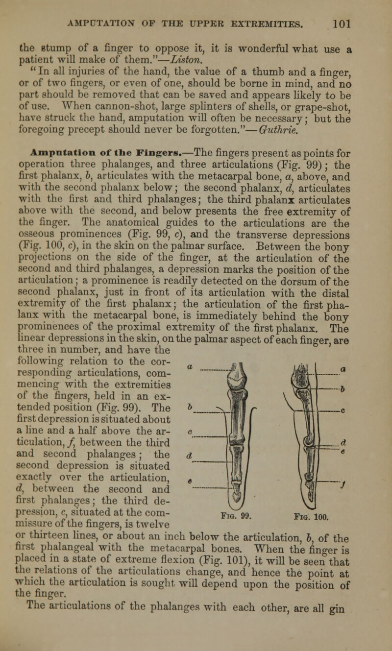 the etump of a finger to oppose it, it is wonderful what use a patient will make of them.—Liston.  In all injuries of the hand, the value of a thumb and a finger, or of two fingers, or even of one, should be borne in mind, and no part should be removed that can be saved and appears likely to be of use. When cannon-shot, large splinters of shells, or grape-shot, have struck the hand, amputation will often be necessary; but the foregoing precept should never be forgotten.—Guthrie. Amputation of the Fingers.—The fingers present as points for operation three phalanges, and three articulations (Fig. 99); the first phalanx, b, articulates with the metacarpal bone, a, above, and with the second phalanx below; the second phalanx, d, articulates with the first and third phalanges; the third phalanx articulates above with the second, and below presents the free extremity of the finger. The anatomical guides to the articulations are the osseous prominences (Fig. 99, c), and the transverse depressions (Fig. 100, c), in the skin on the palmar surface. Between the bony projections on the side of the finger, at the articulation of the second and third phalanges, a depression marks the position of the articulation; a prominence is readily detected on the dorsum of the second phalanx, just in front of its articulation with the distal extremity of the first phalanx; the articulation of the first pha- lanx with the metacarpal bone, is immediately behind the bony prominences of the proximal extremity of the first phalanx. The linear depressions in the skin, on the palmar aspect of each finger, are three in number, and have the following relation to the cor- responding articulations, com- mencing with the extremities of the fingers, held in an ex- tended position (Fig. 99). The first depression is situated about a line and a half above the ar- ticulation, /, between the third and second phalanges; the second depression is situated exactly over the articulation, d, between the second and first phalanges; the third de- pression, c, situated at the com- missure of the fingers, is twelve or thirteen lines, or about an inch below the articulation, b, of the first phalangeal with the metacarpal bones. When the finger is placed in a state of extreme flexion (Fig. 101), it will be seen that the relations of the articulations change, and hence the point at which the articulation is sought will depend upon the position of the finger. The articulations of the phalanges with each other, are all gin
