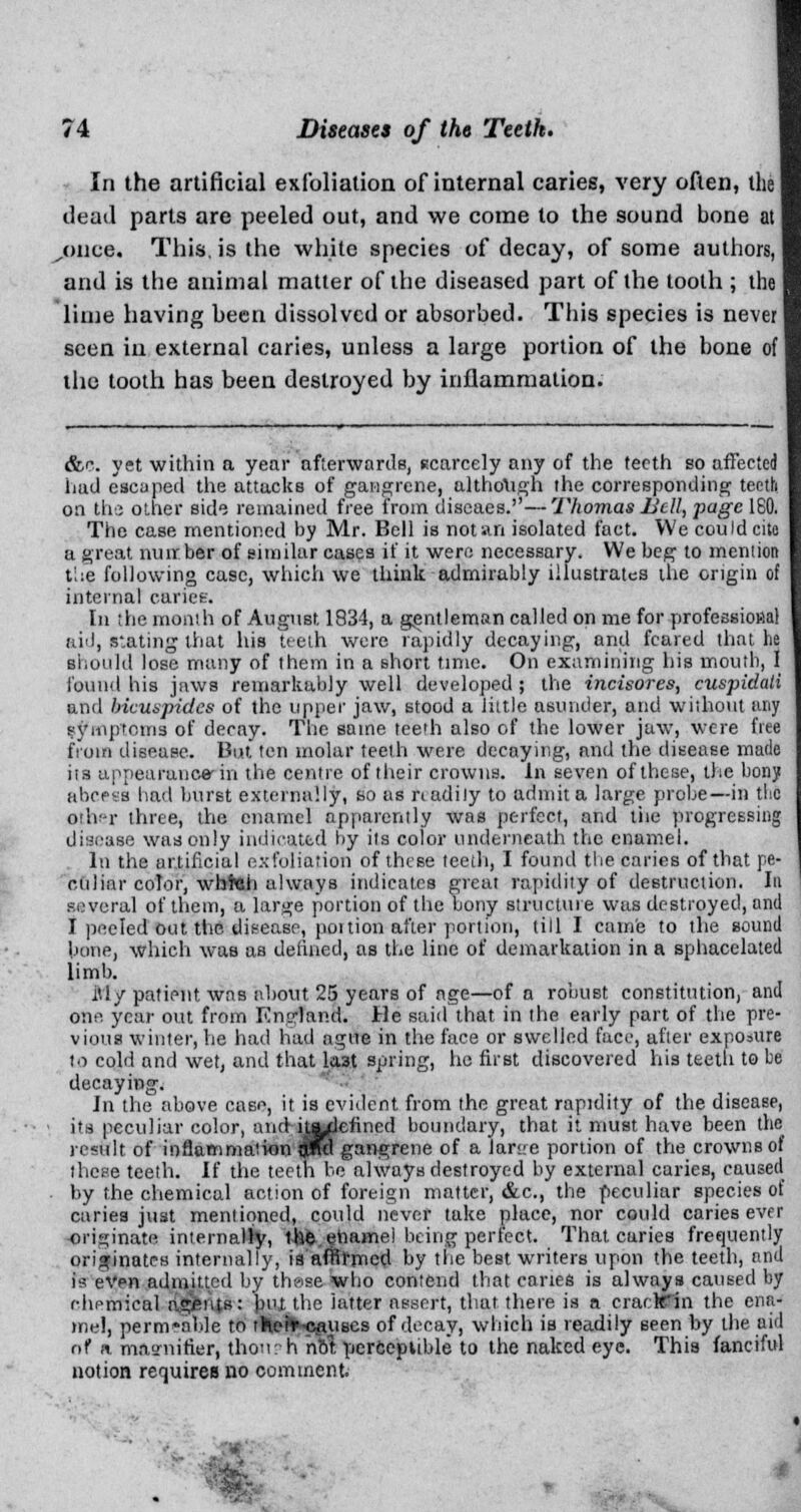 In the artificial exfoliation of internal caries, very often, the dead parts are peeled out, and we come to the sound bone at /nice. This, is the white species of decay, of some authors, and is the animal matter of the diseased part of the tooth ; the lime having been dissolved or absorbed. This species is never seen in external caries, unless a large portion of the bone of the tooth has been destroyed by inflammation. &r. yet within a year afterwards, scarcely any of the teeth so affected had escaped the attacks of gangrene, although the corresponding teeth on the: other side remained free from diseaes.—Thomas Hell, page ISO. The case mentioned by Mr. Bell is not an isolated fact. We could cite a great nuirber of similar cases if it were necessary. We beg to mention the following case, which we think admirably illustrates the origin of internal caries. In the month of August 1834, a gentleman called on me for professional aid, Staging that his teeth were rapidly decaying, and feared that lie ■hould lose many of them in a short time. On examining his mouth, I found his jaws remarkably well developed ; the incisores, cuspidati and bicuspides of the upper jaw, stood a little asunder, and without any symptoms of decay. The same teerh also of the lower jaw, were free from disease. But ten molar teeth were decaying, and the disease made ita appearance-in the centre of their crowns. In seven of these, the bony abceag had burst externally, so as readily to admit a large probe—in the other three, the enamel apparently was perfect, and the progressing disease was only indicated by its color underneath the enamel. In the artificial exfoliation of these teeth, I found the caries of that pe- culiar color, wbtah always indicates great rapidity of destruction. In several of them, a large portion of the bony structure was destroyed, and I peeled out the. disease, poition after portion, till I came to the sound bone, which was as defined, as the line of demarcation in a sphacelated limb. ill/ patient was about 25 years of age—of a robust constitution, and one year out from Knprland. He said that in the early part of the pre- vious winter, he had had ague in the face or swelled face, after exposure to cold and wet, and that last spring, he first discovered his teeth to be decaying. In the above case, it is evident from the great rapidity of the disease, its peculiar color, and undefined boundary, that it must have been the result of inflammation $no gangrene of a lanre portion of the crowns of these teeth. If the teeth be always destroyed by external caries, caused by the chemical action of foreign matter, &c, the peculiar species of caries just mentioned, could never take place, nor could caries ever •originate internally, the enamel being perfect. That caries frequently originates internally, is'afRfmed by the best writers upon the teeth, and is even admitted by these who contend that canes is always caused by chemical agents: but the latter assert, that there is a cracfcHn the ena- mel, permeable to thet*-c£uses of decay, which is readily seen by the aid of <i magnifier, thou :h nol perceptible to the naked eye. This fanciful notion requires no comment.