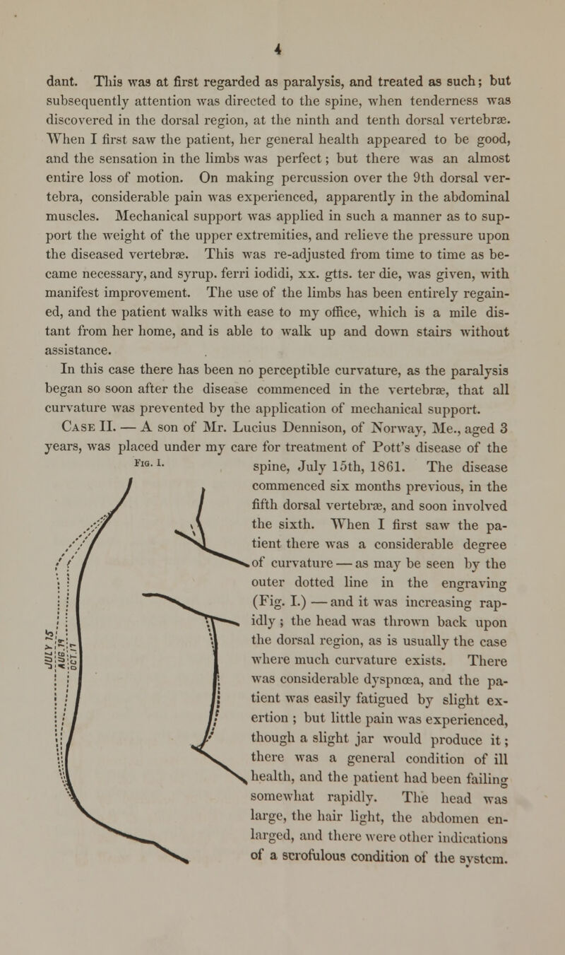 dant. This was at first regarded as paralysis, and treated as such; but subsequently attention was directed to the spine, when tenderness was discovered in the dorsal region, at the ninth and tenth dorsal vertebrae. When I first saw the patient, her general health appeared to be good, and the sensation in the limbs was perfect; but there was an almost entire loss of motion. On making percussion over the 9th dorsal ver- tebra, considerable pain was experienced, apparently in the abdominal muscles. Mechanical support was applied in such a manner as to sup- port the weight of the upper extremities, and relieve the pressure upon the diseased vertebrae. This was re-adjusted from time to time as be- came necessary, and syrup, ferri iodidi, xx. gtts. ter die, was given, with manifest improvement. The use of the limbs has been entirely regain- ed, and the patient walks with ease to my office, which is a mile dis- tant from her home, and is able to walk up and down stairs without assistance. In this case there has been no perceptible curvature, as the paralysis began so soon after the disease commenced in the vertebrae, that all curvature was prevented by the application of mechanical support. Case II. — A son of Mr. Lucius Dennison, of Norway, Me., aged 3 years, was placed under my care for treatment of Pott's disease of the spine, July 15th, 1861. The disease commenced six months previous, in the fifth dorsal vertebrae, and soon involved the sixth. When I first saw the pa- tient there was a considerable degree .of curvature — as may be seen by the outer dotted line in the engravine (Fig. I.) — and it was increasing rap- idly ; the head Avas thrown back upon the dorsal region, as is usually the case where much curvature exists. There was considerable dyspnoea, and the pa- tient was easily fatigued by slight ex- ertion ; but little pain was experienced, though a slight jar would produce it; there was a general condition of ill health, and the patient had been failing somewhat rapidly. The head was large, the hair light, the abdomen en- larged, and there were other indications of a scrofulous condition of the system.