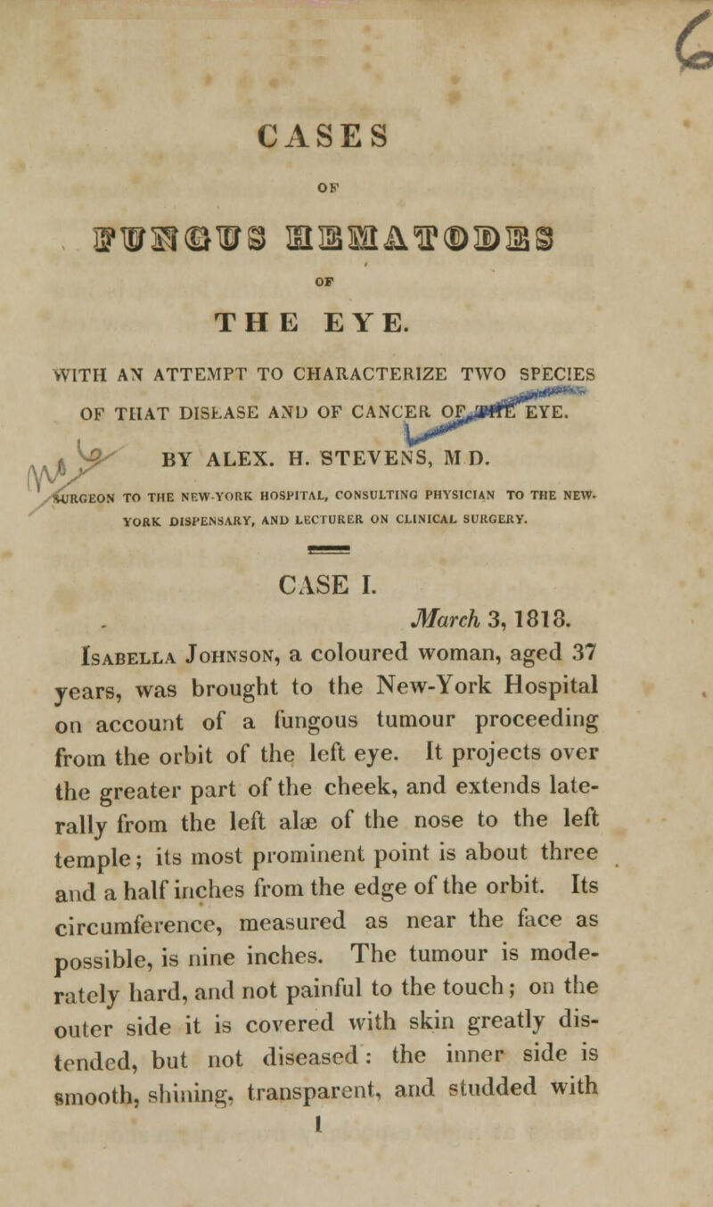 CASES OF iFw^r^w^ miBmiiWQDiDiss OF THE EYE. WITH AN ATTEMPT TO CHARACTERIZE TWO SPECIES OF THAT DISEASE AND OF CANCER OT^MfEEYE. BY ALEX. H. STEVENS, M D. RGEON TO THE NEW-YORK HOSPITAL, CONSULTING PHYSICIAN TO THE NEW- YORK DISPENSARY, AND LECTURER ON CLINICAL SURGERY. CASE I. March 3,1813. Isabella Johnson, a coloured woman, aged 37 years, was brought to the New-York Hospital on account of a fungous tumour proceeding from the orbit of the left eye. It projects over the greater part of the cheek, and extends late- rally from the left alae of the nose to the left temple; its most prominent point is about three and a half inches from the edge of the orbit. Its circumference, measured as near the face as possible, is nine inches. The tumour is mode- rately hard, and not painful to the touch; on the outer side it is covered with skin greatly dis- tended, but not diseased: the inner side is smooth, shining, transparent, and studded with