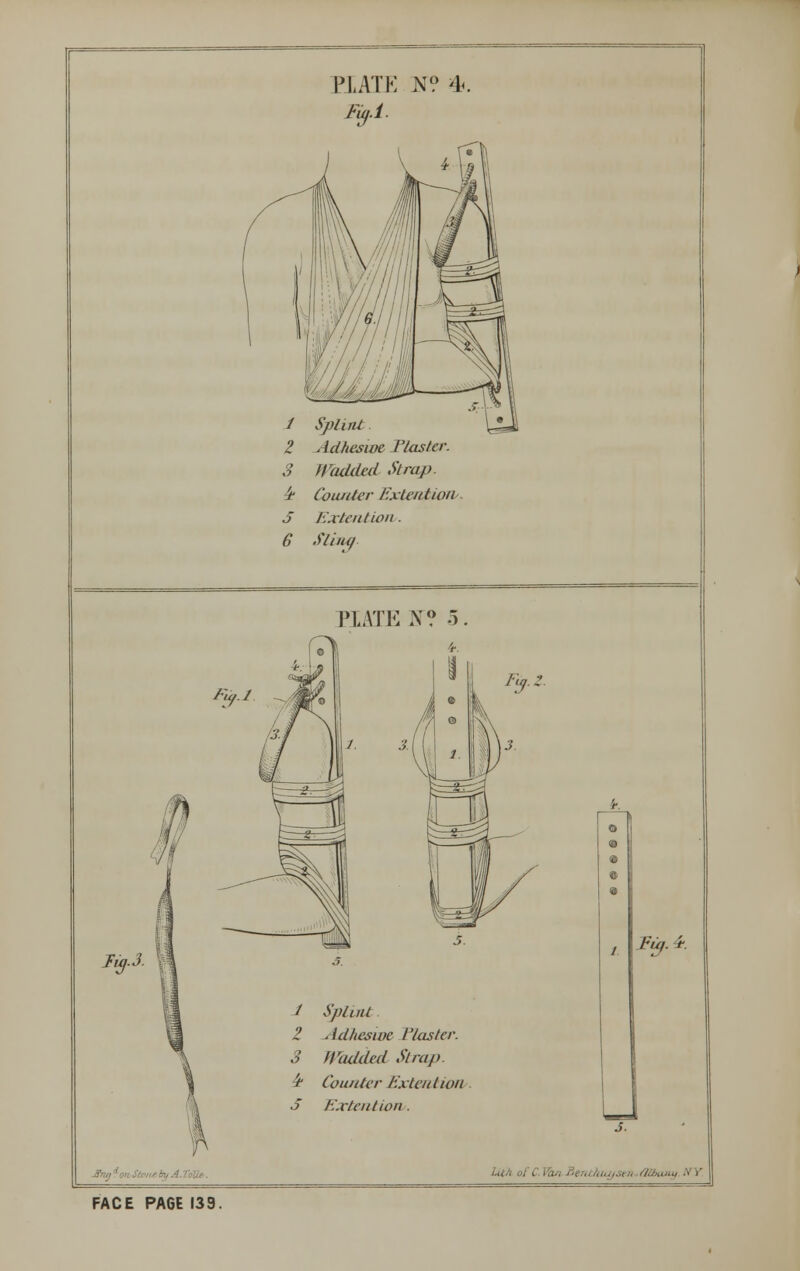 Fig- PIAIE N? 4* Fu,.l. 1 Splint 2 Adhesive Piaster. 3 Wadded Strap. 4* Counter Exteniion J Extension. 6 Sling PTATE N? 5. ]-.n.:. 1 Splint 2 Adhesive t'lasta: 3 Wadded Strap. '* Counter Exteniion 5 Exteniion. % a. e J FACE PAGE 139.