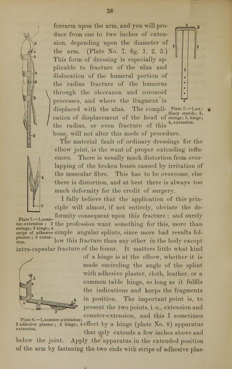 B H 3 forearm upon the arm, and you will pro- duce from one to two inches of exten- sion, depending upon the diameter of the arm. (Plate No. 1, fig. 1, 2, 3.) This form of dressing is especially ap- plicable to fracture of the ulna and dislocation of the humeral portion of the radius fracture of the humerus through the olecranon and coronoid processes, and where the fragment is displaced with the ulna. The compli- Plate 7.—l,ax- _ _ t illary crutch; 2, cation of displacement of the head of strings; 3, hinge; ., ,. P , r ., . 4, extension. the radius, or even fracture ot this bone, will not alter this mode of procedure. The material fault of ordinary dressings for the elbow joint, is the want of proper extending influ- ences. There is usually much distortion from over- lapping of the broken bones caused by irritation of the muscular fibre. This has to be overcome, else there is distortion, and at best there is always too much deformity for the credit of surgery. I fully believe that the application of this prin- ciple will almost, if not entirely, obviate the de- formity consequent upon this fracture ; and surely ter-extension ; 2 the profession want something for this, more than strings; 3 hinge ; 4 . strips of adhesive simple angular splints, since more bad results tol- sion. low this fracture than any other in the body except intra-capsular fracture of the femur. It matters little what kind of a hinge is at the elbow, whether it is made encircling the angle of the splint with adhesive plaster, cloth, leather, or a common table hinge, so long as it fulfils the indications and keeps the fragments in position. The important point is, to present the two points, i. e., extension and counter-extension, and this I sometimes Plate 8.—1,counter-extension; 2 adhesive piaster; 3 hinge; 4 effect by a hinge (plate No. 8) apparatus extension. , . that only extends a lew inches above and below the joint. Apply the apparatus in the extended position of the arm by fastening the two ends with strips of adhesive plas-