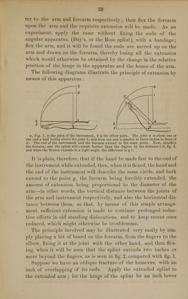 ter to the arm and forearm respectively; then flex the forearm upon the arm and the requisite extension will be made. As an experiment, apply the same without fixing the ends of the angular apparatus, (Day's, or the Rose splint), with a bandage; flex the arm, and it will be found the ends are moved up on the arm and drawn on the forearm, thereby losing all the extension which would otherwise be obtained by the change in the relative position of the hinge in the apparatus and the bones of the arm. The following diagrams illustrate the principle of extension by means of this apparatus : G z/ 1 /d2<C \ \\j (A \Jb~~ .. a, Fig. 1, is the joint of the instrument, b is the elbow joint. The joint a is about one or one and a half inches above the joint b, and from one and a quarter to three inches in front of it. The end of the instrument and the forearm extend to the same point. Now, semiflex the forearm, and the splint will extend farther than the fingers by the distance c d, fig. 2, and when the flexion extends to a right angle, the difference is g i. It is plain, therefore, that if the hand be made fast to the end of the instrument while extended, then, when it is flexed, the hand and the end of the instrument will describe the same circle, and both extend to the point g, the forearm being forcibly extended, the amount of extension being proportional to the diameter of the arm—in other words, the vertical distance between the joints of the arm and instrument respectively, and also the horizontal dis- tance between them, so that, by means of this simple arrange- ment, sufficient extension is made to continue prolonged reduc- tive efforts in old standing dislocations, and to keep recent ones reduced, which might otherwise be troublesome. The principle involved may be illustrated very easily by sim- ply placing a bit of board on the forearm, from the fingers to the elbow, fixing it at the joint with the other hand, and then flex- ing, when it will be seen that the splint extends two inches or more beyond the fingers, as is seen in fig. 2, compared with fig. 1. Suppose we have an oblique fracture of the humerus, with an inch of overlapping of its ends. Apply the extended splint to the extended arm : let the hinge of the splint be an inch lower