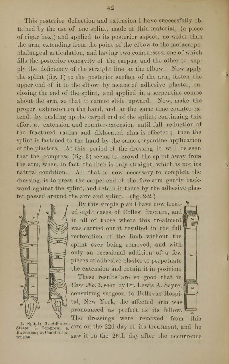 This posterior deflection and extension I have successfully ob- tained by the use of one splint, made of thin material, (a piece of cigar box,) and applied to its posterior aspect, no wider than the arm, extending from the point of the elbow to the metacarpo- phalangeal articulation, and having two compresses, one of which fills the posterior concavity of the carpus, and the other to sup- ply the deficiency of the straight line at the elbow. Now apply the splint (fig. 1) to the posterior surface of the arm, fasten the upper end of it to the elbow by means of adhesive plaster, en- closing the end of the splint, and applied in a serpentine course about the arm, so that it cannot slide upward. Now, make the proper extension on the hand, and at the same time counter-ex- tend, by pushing up the carpel end of the splint, continuing this effort at extension and counter-extension until full reduction of the fractured radius and dislocated ulna is effected ; then the splint is fastened to the hand by the same serpentine application of the plasters. At this period of the dressing it will be seen that the compress (fig. 3) seems to crowd the splint away from the arm, when, in fact, the limb is only straight, which is not its natural condition. All that is now necessary to complete the dressing, is to press the carpel end of the fore-arm gently back- ward against the splint, and retain it there by the adhesive plas- ter passed around the arm and splint, (fig. 2-2.) By this simple plan I have now treat- ed eight cases of Colles' fracture, and in all of those where this treatment! was carried out it resulted in the full restoration of the limb without the splint ever being removed, and with only an occasional addition of a few pieces of adhesive plaster to perpetuate the extension and retain it in position. These results are so good that in Case No. 3, seen by Dr. Lewis A. Sayre, consulting surgeon to Bellevue Hospi- tal, New York, the affected arm was pronounced as perfect as its fellow. The dressings were removed from this Straps;P s. 'compressfT arm on the 22d day of its treatment, and he Extension; 5. Counter-ex- ., ,, n^.i i •>, ,-, tension. saw it on the 26th day after the occurrence