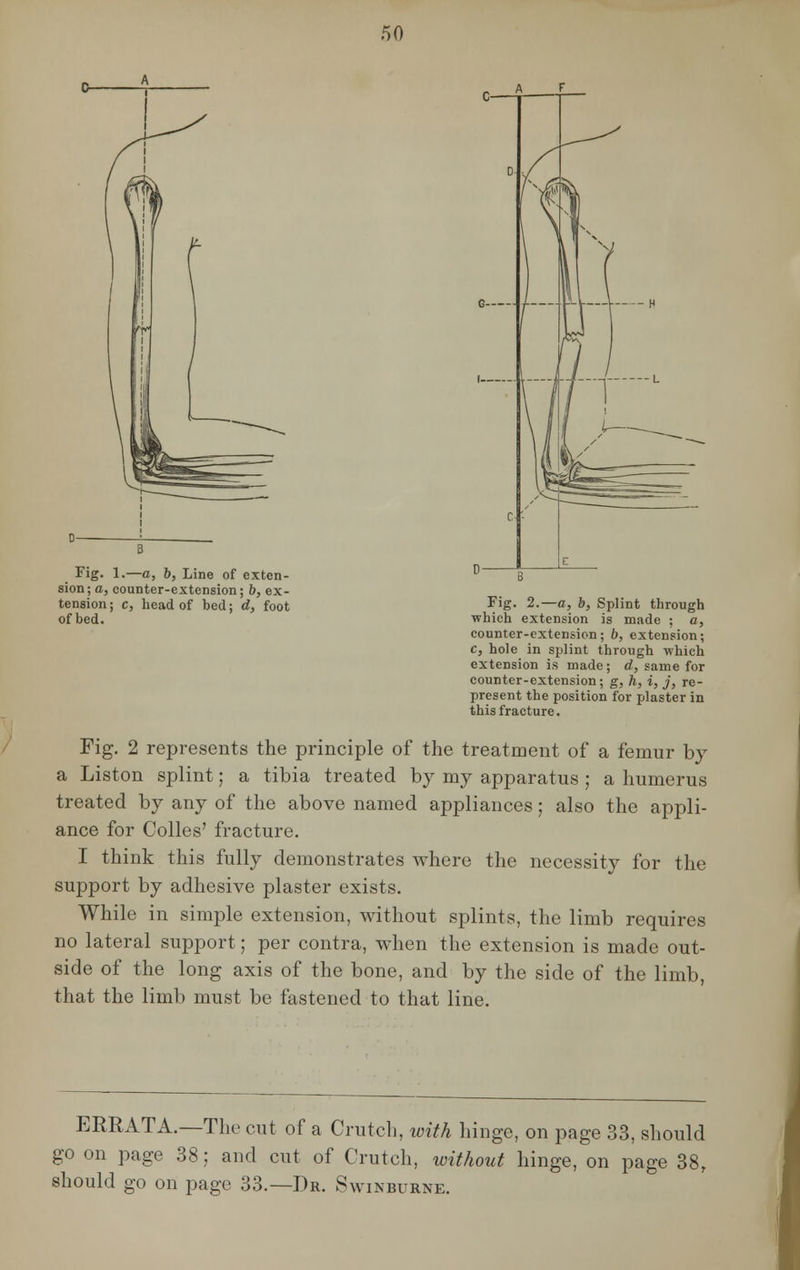 Fig. 1.—a, b, Line of exten- sion; a, counter-extension; b, ex- tension; c, head of bed; d, foot Fig. 2.—a, b, Splint through of bed. which extension is made ; a, counter-extension; b, extension; c, hole in splint through which extension is made; d, same for counter-extension; g, h, i, j, re- present the position for plaster in this fracture. Fig. 2 represents the principle of the treatment of a femur by a Liston splint; a tibia treated by my apparatus ; a humerus treated by any of the above named appliances; also the appli- ance for Colles' fracture. I think this fully demonstrates where the necessity for the support by adhesive plaster exists. While in simple extension, without splints, the limb requires no lateral support; per contra, when the extension is made out- side of the long axis of the bone, and by the side of the limb, that the limb must be fastened to that line. ERRATA.—The cut of a Crutch, with hinge, on page 33, should go on page 38; and cut of Crutch, without hinge, on page 38r should go on page 33.—Dr. Swinburne.