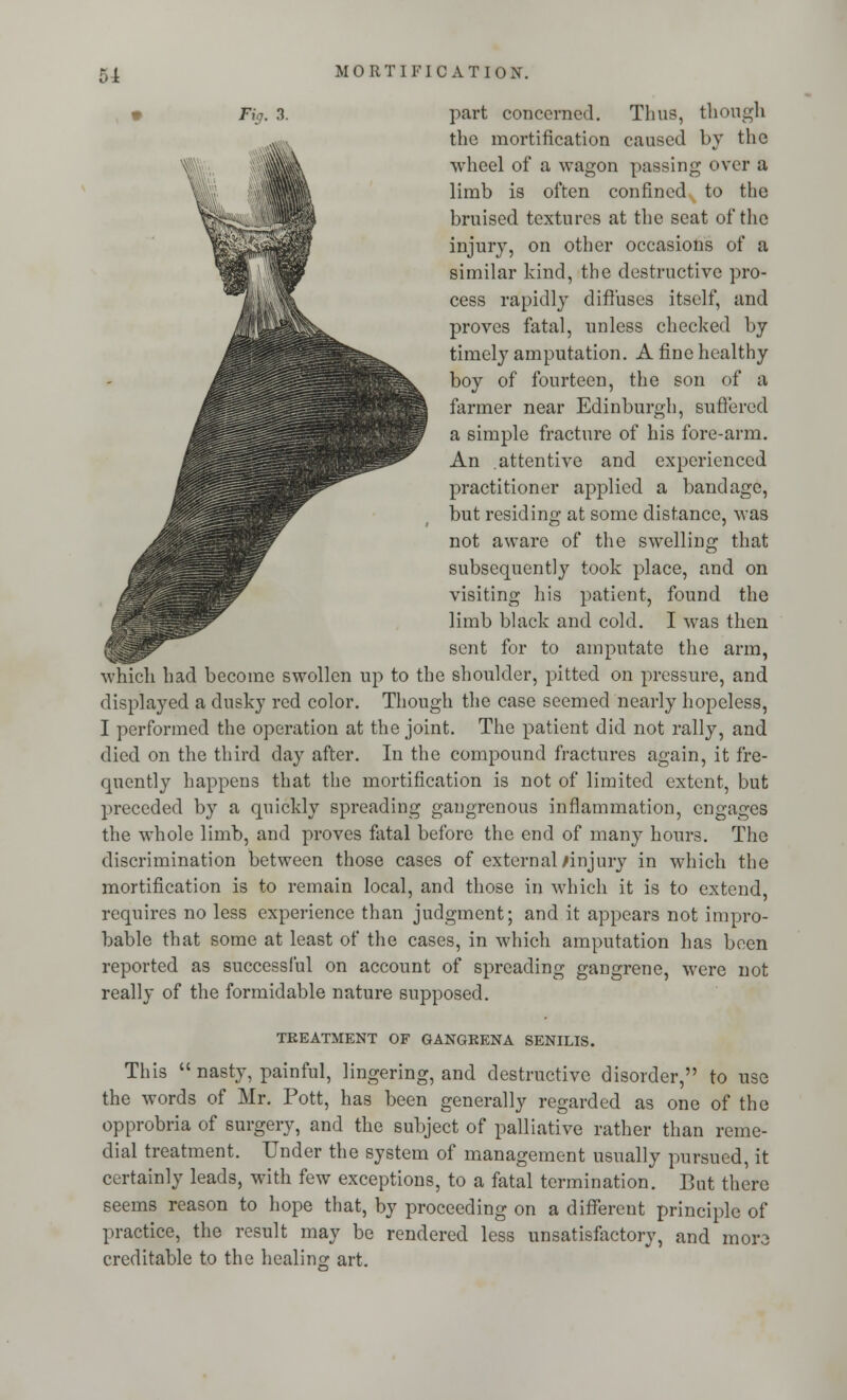 Fig. 3. part concerned. Thus, though the mortification caused by the wheel of a wagon passing over a limb is often con fined s to the bruised textures at the seat of the injury, on other occasions of a similar kind, the destructive pro- cess rapidly diffuses itself, and proves fatal, unless checked by timely amputation. A fine healthy boy of fourteen, the son of a farmer near Edinburgh, suffered a simple fracture of his fore-arm. An attentive and experienced practitioner applied a bandage, but residing at some distance, was not aware of the swelling that subsequently took place, and on visiting his patient, found the limb black and cold. I was then sent for to amputate the arm, which had become swollen up to the shoulder, pitted on pressure, and displayed a dusky red color. Though the case seemed nearly hopeless, I performed the operation at the joint. The patient did not rally, and died on the third day after. In the compound fractures again, it fre- quently happens that the mortification is not of limited extent, but preceded by a quickly spreading gangrenous inflammation, engages the whole limb, and proves fatal before the end of many hours. The discrimination between those cases of external/injury in which the mortification is to remain local, and those in which it is to extend, requires no less experience than judgment; and it appears not impro- bable that some at least of the cases, in which amputation has been reported as successful on account of spreading gangrene, were not really of the formidable nature supposed. TREATMENT OF GANGRENA SENILIS. This  nasty, painful, lingering, and destructive disorder, to use the words of Mr. Pott, has been generally regarded as one of the opprobria of surgery, and the subject of palliative rather than reme- dial treatment. Under the system of management usually pursued, it certainly leads, with few exceptions, to a fatal termination. But there seems reason to hope that, by proceeding on a different principle of practice, the result may be rendered less unsatisfactory, and mora creditable to the healing art.