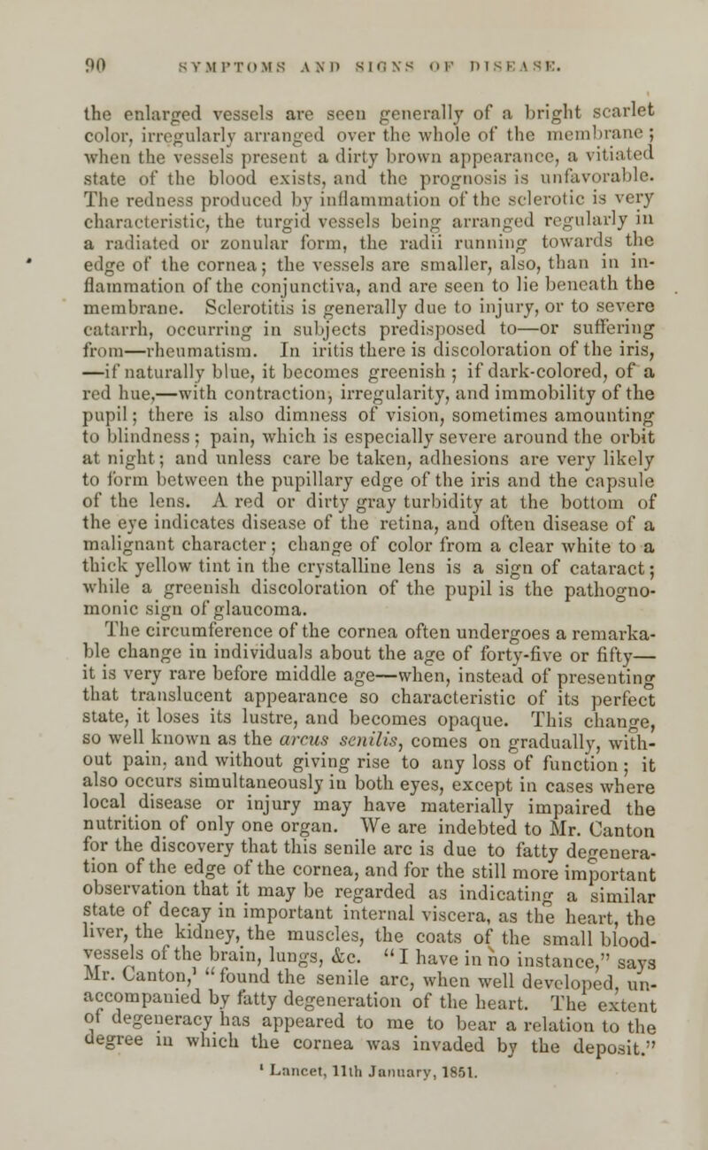 the enlarged vessels are seen generally of a bright scarlet color, irregularly arranged over the whole of the membrane: when the vessels present a dirty brown appearance, a vitiated state of the blood exists, and the prognosis is unfavorable. The redness produced by inflammation of the sclerotic is very characteristic, the turgid vessels being arranged regularly in a radiated or zonular form, the radii running towards the edge of the cornea; the vessels are smaller, also, than in in- flammation of the conjunctiva, and are seen to lie beneath the membrane. Sclerotitis is generally due to injury, or to severe catarrh, occurring in subjects predisposed to—or suffering from—rheumatism. In iritis there is discoloration of the iris, —if naturally blue, it becomes greenish ; if dark-colored, of a red hue,—with contraction, irregularity, and immobility of the pupil; there is also dimness of vision, sometimes amounting to blindness; pain, which is especially severe around the orbit at night; and unless care be taken, adhesions are very likely to form between the pupillary edge of the iris and the capsule of the lens. A red or dirty gray turbidity at the bottom of the eye indicates disease of the retina, and often disease of a malignant character; change of color from a clear white to a thick yellow tint in the crystalline lens is a sign of cataract; while a greenish discoloration of the pupil is the pathogno- monic sign of glaucoma. The circumference of the cornea often undergoes a remarka- ble change in individuals about the age of forty-five or fifty— it is very rare before middle age—when, instead of presenting that translucent appearance so characteristic of its perfect state, it loses its lustre, and becomes opaque. This change, so well known as the arms senilis, comes on gradually, with- out pain, and without giving rise to any loss of function ; it also occurs simultaneously iu both eyes, except in cases where local disease or injury may have materially impaired the nutrition of only one organ. We are indebted to Mr. Canton for the discovery that this senile arc is due to fatty degenera- tion of the edge of the cornea, and for the still more important observation that it may be regarded as indicating a similar state of decay in important internal viscera, as the heart, the liver, the kidney, the muscles, the coats of the small blood- vessels of the brain, lungs, &c.  I have in no instance, says Mr. Canton,' found the senile arc, when well developed un- accompanied by fatty degeneration of the heart. The extent of degeneracy has appeared to me to bear a relation to the degree in which the cornea was invaded by the deposit. ' Lancet, llih January, 1851.