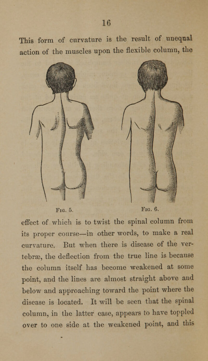 This form of curvature is the result of unequal action of the muscles upon the flexible column, the Fia. 5. Fig. 6. effect of which is to twist the spinal column from its proper course—in other words, to make a real curvature. But when there is disease of the ver- tebrae, the deflection from the true line is because the column itself has become weakened at some point, and the lines are almost straight above and below and approaching toward the point where the disease is located. It will be seen that the spinal column, in the latter case, appears to have toppled over to one side at the weakened point, and this