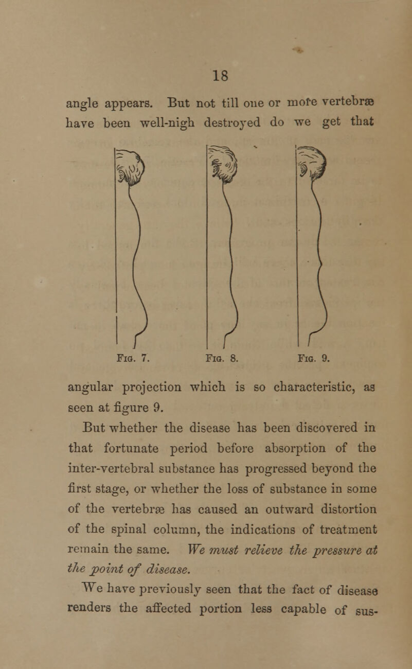 angle appears. But not till one or more vertebrae have been well-nigh destroyed do we get that Fig. 7. Fig. 8. Fig. 9. angular projection which is so characteristic, aa seen at figure 9. But whether the disease has been discovered in that fortunate period before absorption of the inter-vertebral substance has progressed beyond the first stage, or whether the loss of substance in some of the vertebras has caused an outward distortion of the spinal column, the indications of treatment remain the same. We must relieve the pressure at the point of disease. We have previously seen that the fact of disease renders the affected portion less capable of sus-