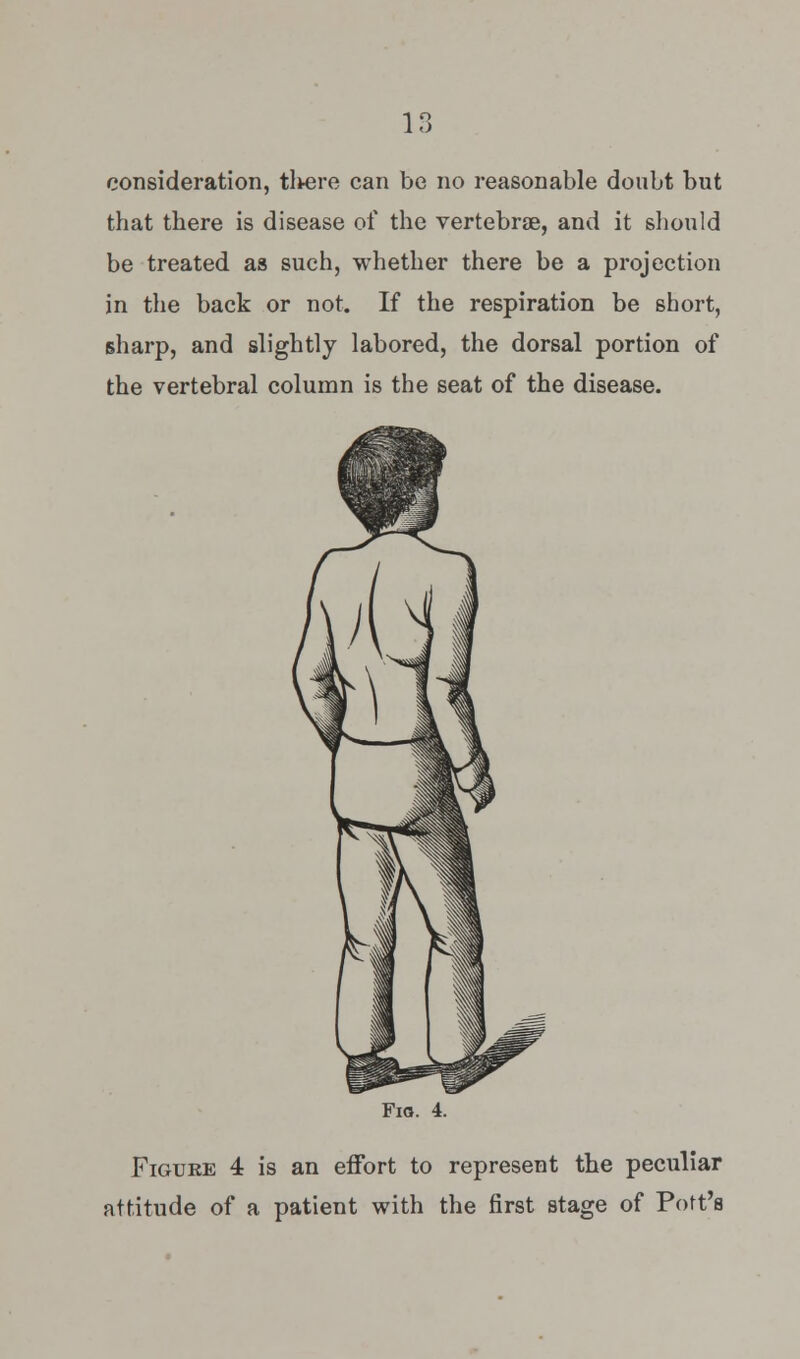 consideration, tl*ere can be no reasonable doubt but that there is disease of the vertebrae, and it should be treated as such, whether there be a projection in the back or not. If the respiration be short, sharp, and slightly labored, the dorsal portion of the vertebral column is the seat of the disease. Fig. 4. Figure 4 is an effort to represent the peculiar attitude of a patient with the first stage of Pott's