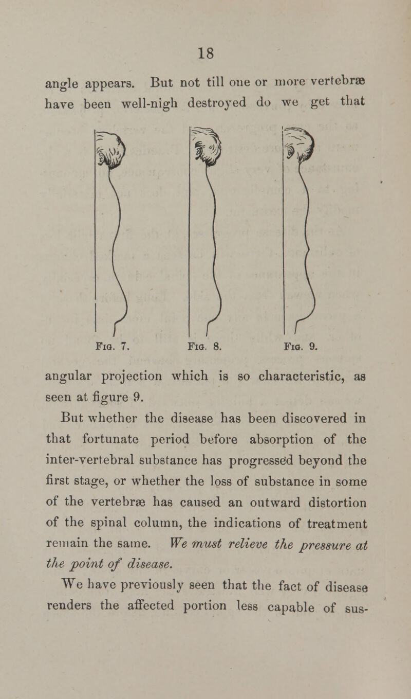 angle appears. But not till one or more vertebrae have been well-nigh destroyed do we get that FlQ. Fio. 8. Fig. 9. angular projection which is so characteristic, as seen at figure 9. But whether the disease has been discovered in that fortunate period before absorption of the inter-vertebral substance has progressed beyond the first stage, or whether the loss of substance in some of the vertebras has caused an outward distortion of the spinal column, the indications of treatment remain the same. We must relieve the pressure at the point of disease. We have previously seen that the fact of disease renders the affected portion less capable of sus-