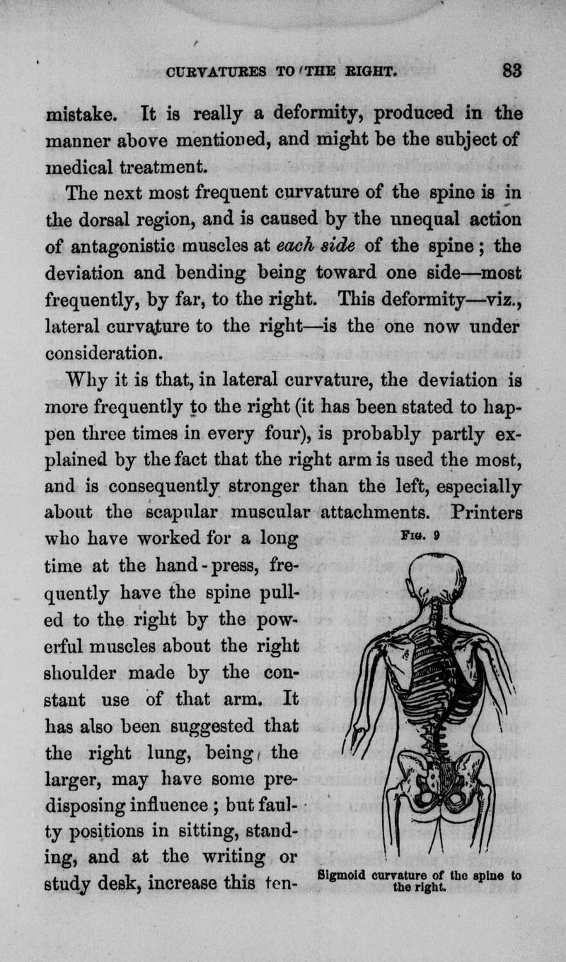 mistake. It is really a deformity, produced in the manner above mentioned, and might be the subject of medical treatment. The next most frequent curvature of the spine is in the dorsal region, and is caused by the unequal action of antagonistic muscles at each side of the spine ; the deviation and bending being toward one side—most frequently, by far, to the right. This deformity—viz., lateral curvajture to the right—is the one now under consideration. Why it is that, in lateral curvature, the deviation is more frequently to the right (it has been stated to hap- pen three times in every four), is probably partly ex- plained by the fact that the right arm is used the most, and is consequently stronger than the left, especially about the scapular muscular attachments. Printers who have worked for a long time at the hand-press, fre- quently have the spine pull- ed to the right by the pow- erful muscles about the right shoulder made by the con- stant use of that arm. It has also been suggested that the right lung, being/ the larger, may have some pre- disposing influence; but faul- ty positions in sitting, stand- ing, and at the writing or , j j t_ i—^rt.---- aXJU, *„„ Sigmoid curvature of the spine to study desk, increase this ten- 6 the right. Fib. 9