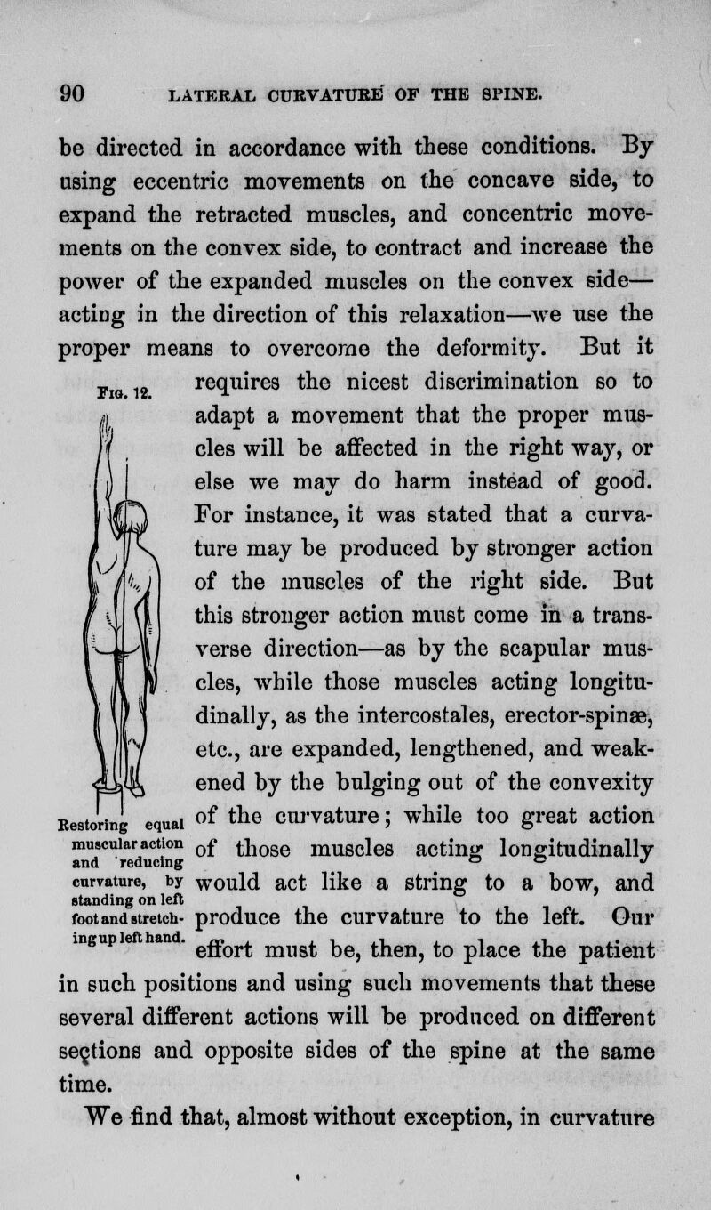 \\J be directed in accordance with these conditions. By using eccentric movements on the concave side, to expand the retracted muscles, and concentric move- ments on the convex side, to contract and increase the power of the expanded muscles on the convex side— acting in the direction of this relaxation—we use the proper means to overcome the deformity. But it fig 12 requires the nicest discrimination so to adapt a movement that the proper mus- cles will be affected in the right way, or else we may do harm instead of good. For instance, it was stated that a curva- ture may be produced by stronger action of the muscles of the right side. But this stronger action must come in a trans- verse direction—as by the scapular mus- cles, while those muscles acting longitu- dinally, as the intercostales, erector-spinse, etc., are expanded, lengthened, and weak- ened by the bulging out of the convexity Residing equal of tne curvature ; while too great action muscular action 0f tilose mugcie8 acting longitudinally and reducing ° ° •> curvature, by would act like a string to a bow, and standing on left foot and stretch- produce the curvature to the left. Our 1 ' effort must be, then, to place the patient in such positions and using such movements that these several different actions will be produced on different sections and opposite sides of the spine at the same time. We find that, almost without exception, in curvature