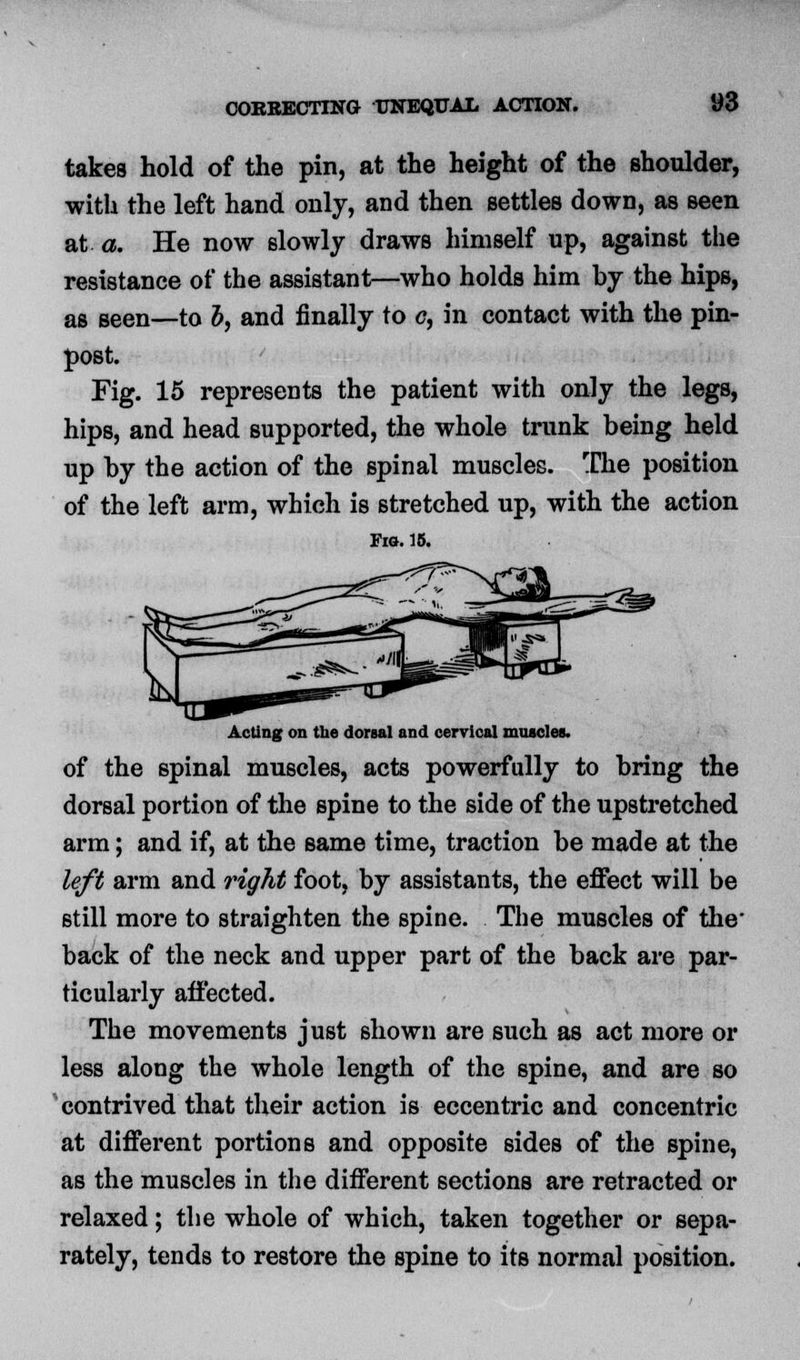 COREECTING UNEQUAL ACTION. 1)3 takes hold of the pin, at the height of the shoulder, with the left hand only, and then settles down, as seen at a. He now slowly draws himself up, against the resistance of the assistant—who holds him by the hips, as seen—to b, and finally to c, in contact with the pin- post. Fig. 15 represents the patient with only the legs, hips, and head supported, the whole trunk being held up by the action of the spinal muscles. The position of the left arm, which is stretched up, with the action Via. 15. Acting on the dorsal and cervical muscles. of the spinal muscles, acts powerfully to bring the dorsal portion of the spine to the side of the upstretched arm; and if, at the same time, traction be made at the left arm and right foot, by assistants, the effect will be still more to straighten the spine. The muscles of the' back of the neck and upper part of the back are par- ticularly affected. The movements just shown are such as act more or less along the whole length of the spine, and are so contrived that their action is eccentric and concentric at different portions and opposite sides of the spine, as the muscles in the different sections are retracted or relaxed; the whole of which, taken together or sepa- rately, tends to restore the spine to its normal position.