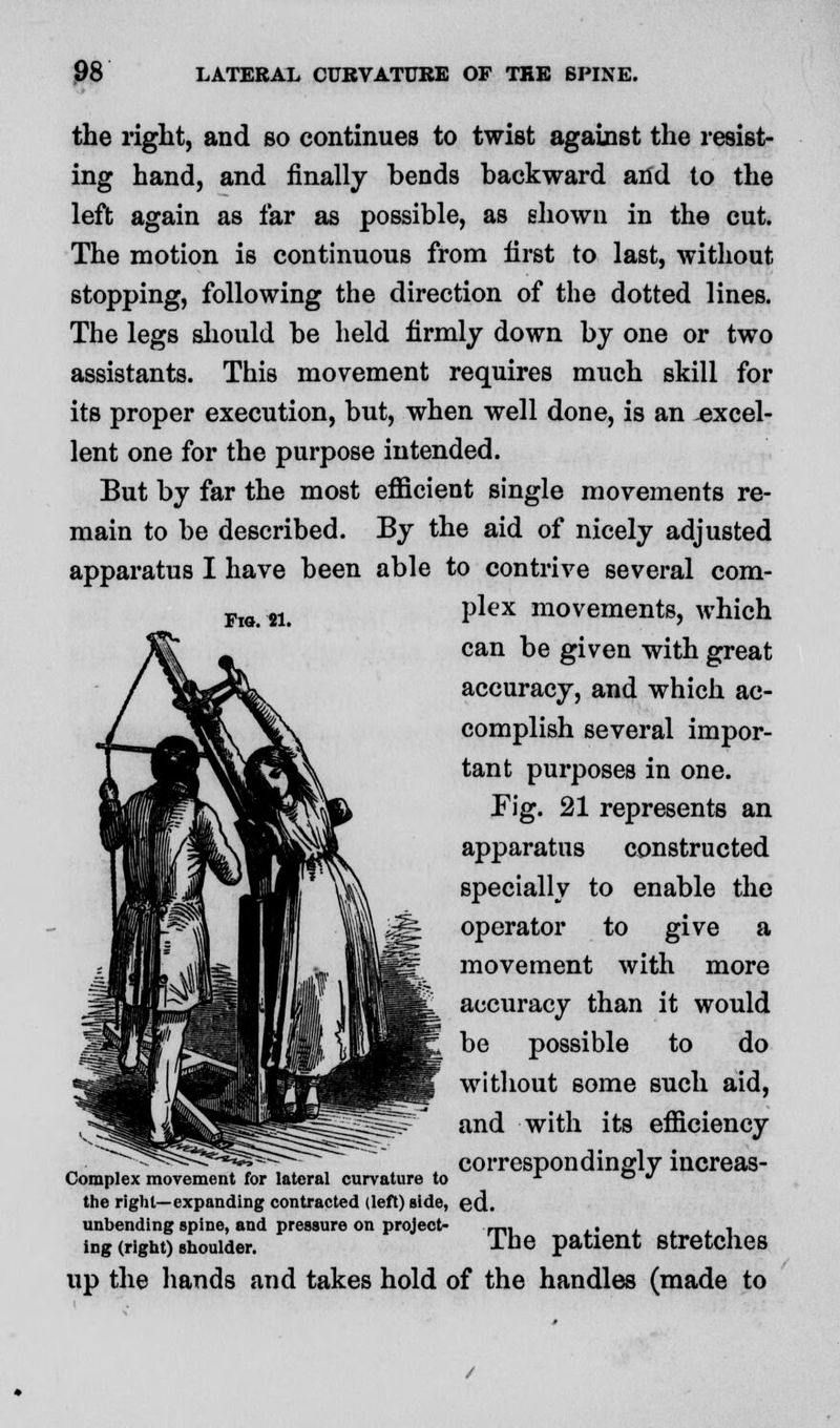 Fig. 21. the right, and so continues to twist against the resist- ing hand, and finally bends backward and to the left again as far as possible, as shown in the cut. The motion is continuous from first to last, without stopping, following the direction of the dotted lines. The legs should be held firmly down by one or two assistants. This movement requires much skill for its proper execution, but, when well done, is an .excel- lent one for the purpose intended. But by far the most efficient single movements re- main to be described. By the aid of nicely adjusted apparatus I have been able to contrive several com- plex movements, which can be given with great accuracy, and which ac- complish several impor- tant purposes in one. Fig. 21 represents an apparatus constructed specially to enable the operator to give a movement with more accuracy than it would be possible to do without some such aid, and with its efficiency correspondingly increas- Complex movement for lateral curvature to * ° * the right—expanding contracted (left) side, ed. unbending spine, and pressure on project- m, . , , ing (right) shoulder. lhe patient stretches up the hands and takes hold of the handles (made to