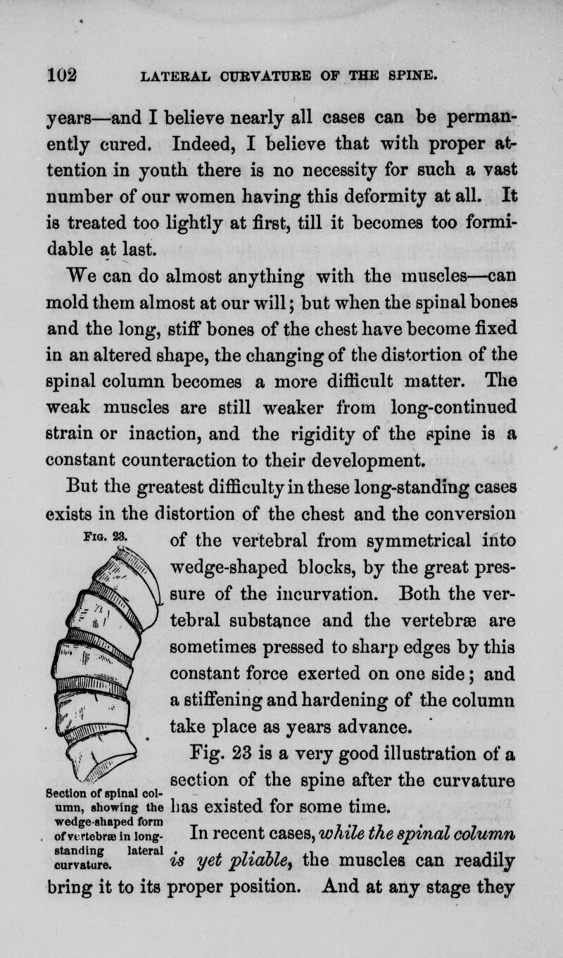 years—and I believe nearly all cases can be perman- ently cured. Indeed, I believe that with proper at- tention in youth there is no necessity for such a vast number of our women having this deformity at all. It is treated too lightly at first, till it becomes too formi- dable at last. We can do almost anything with the muscles—can mold them almost at our will; but when the spinal bones and the long, stiff bones of the chest have become fixed iu an altered shape, the changing of the distortion of the spinal column becomes a more difficult matter. The weak muscles are still weaker from long-continued strain or inaction, and the rigidity of the spine is a constant counteraction to their development. But the greatest difficulty in these long-standing cases exists in the distortion of the chest and the conversion !'* ' of the vertebral from symmetrical into wedge-shaped blocks, by the great pres- sure of the incurvation. Both the ver- tebral substance and the vertebrae are sometimes pressed to sharp edges by this constant force exerted on one side; and a stiffening and hardening of the column take place as years advance. Fig. 23 is a very good illustration of a section of the spine after the curvature Section of spinal col- umn, showing the has existed for some time. wedge-shaped form , ,_ _ , _ ' of vertebra? in long- In recent cases, while the spinal column standing lateral . . <•. *• ,» 1 ■,.-, curvature. w yet pliable^ the muscles can readily bring it to its proper position. And at any stage they