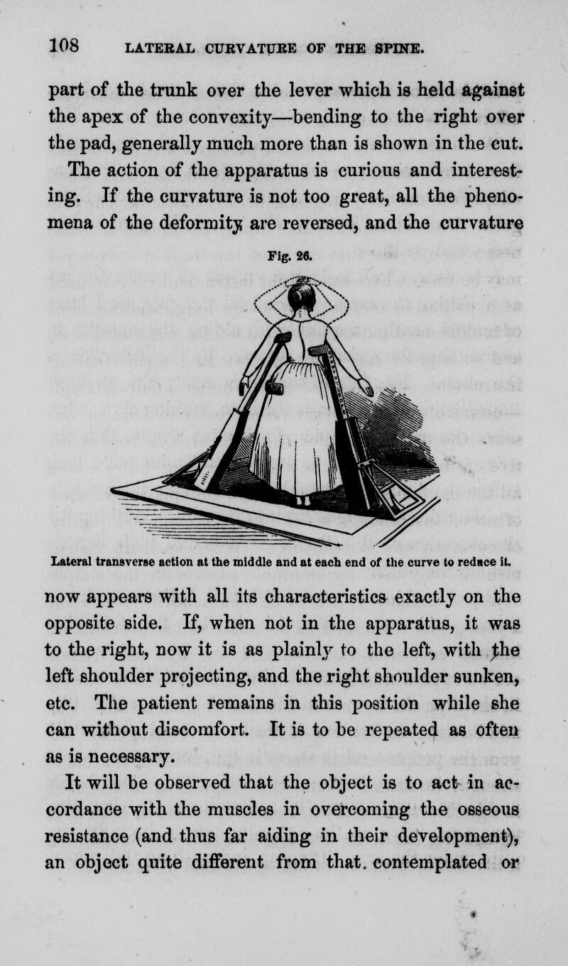 part of the trunk over the lever which is held against the apex of the convexity—bending to the right over the pad, generally much more than is shown in the cut. The action of the apparatus is curious and interest- ing. If the curvature is not too great, all the pheno- mena of the deformity are reversed, and the curvature Fig. s«. Lateral transverse action at the middle and at each end of the curve to reduce it. now appears with all its characteristics exactly on the opposite side. If, when not in the apparatus, it was to the right, now it is as plainly to the left, with Jhe left shoulder projecting, and the right shoulder sunken, etc. The patient remains in this position while she can without discomfort. It is to be repeated as often as is necessary. It will be observed that the object is to act in ac- cordance with the muscles in overcoming the osseous resistance (and thus far aiding in their development), an object quite different from that, contemplated or