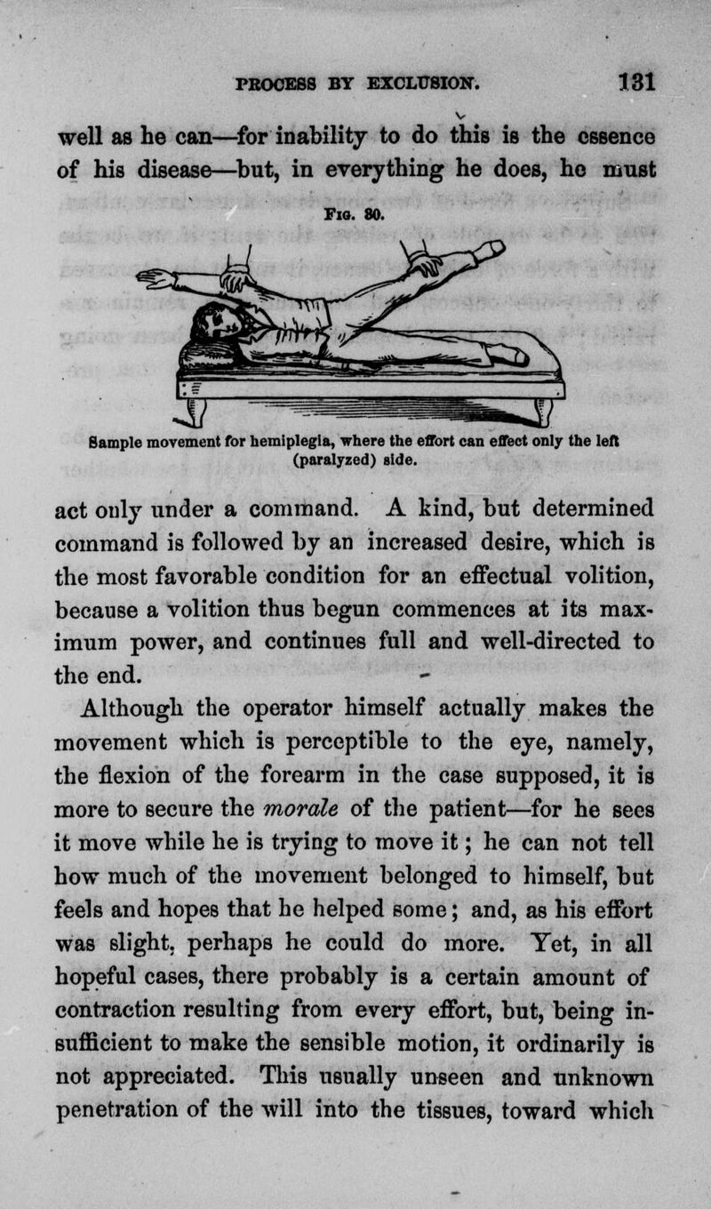 well as he can—for inability to do this is the essence of his disease—but, in everything he does, ho must Fig. 80. Sample movement for hemiplegia, where the effort can effect only the left (paralyzed) side. act ouly under a command. A kind, but determined command is followed by an increased desire, which is the most favorable condition for an effectual volition, because a volition thus begun commences at its max- imum power, and continues full and well-directed to the end. Although the operator himself actually makes the movement which is perceptible to the eye, namely, the flexion of the forearm in the case supposed, it is more to secure the morale of the patient—for he sees it move while he is trying to move it; he can not tell how much of the movement belonged to himself, but feels and hopes that he helped some; and, as his effort was slight, perhaps he could do more. Yet, in all hopeful cases, there probably is a certain amount of contraction resulting from every effort, but, being in- sufficient to make the sensible motion, it ordinarily is not appreciated. This usually unseen and unknown penetration of the will into the tissues, toward which