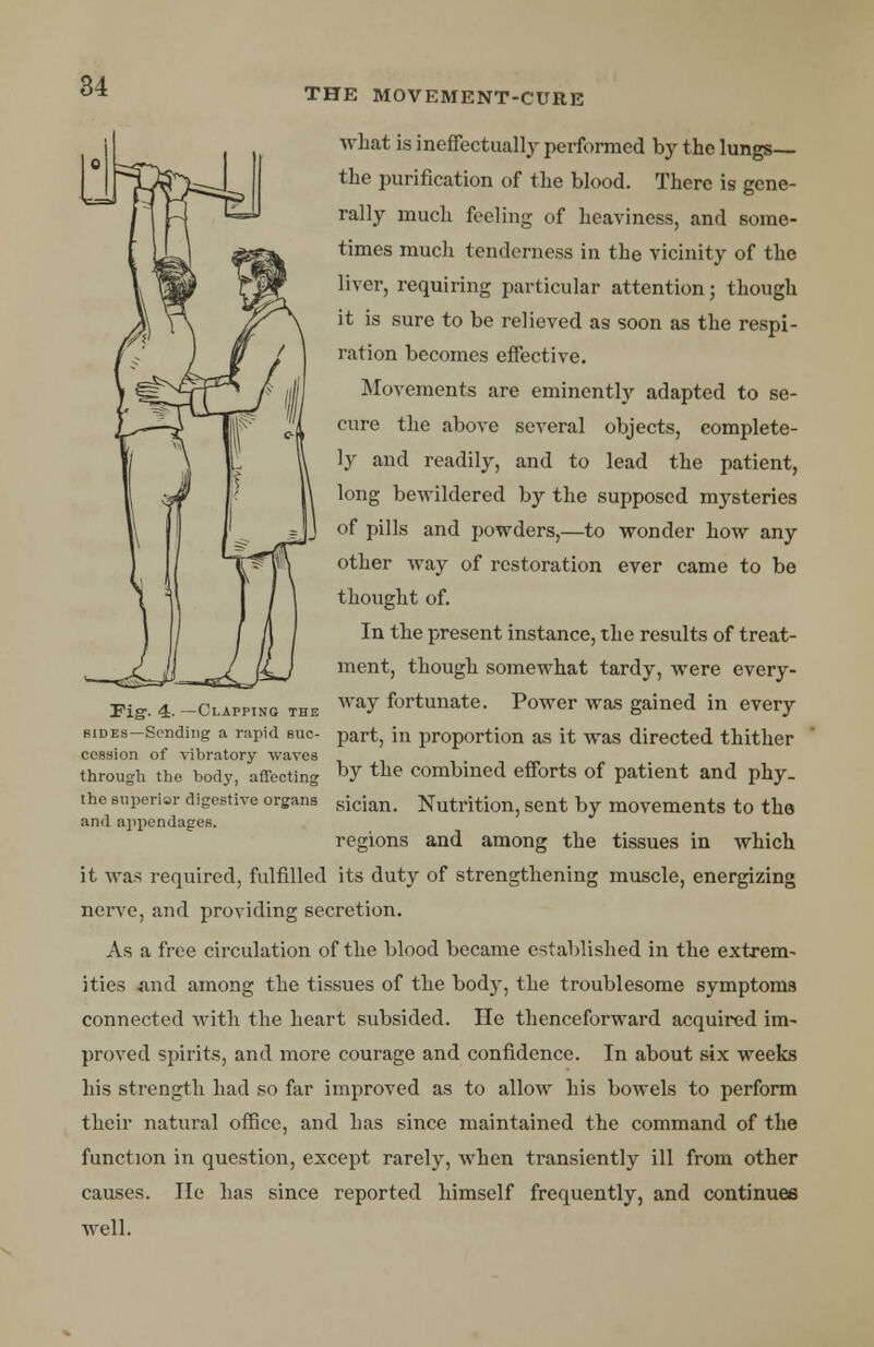 THE MOVEMENT-CURE what is ineffectually performed by the lungs— the purification of the blood. There is gene- rally much feeling of heaviness, and some- times much tenderness in the vicinity of the liver, requiring particular attention; though it is sure to be relieved as soon as the respi- ration becomes effective. Movements are eminent^ adapted to se- cure the above several objects, complete- ly and readily, and to lead the patient, long bewildered by the supposed mysteries of pills and powders,—to wonder how any other way of restoration ever came to be thought of. In the present instance, the results of treat- ment, though somewhat tardy, were every- way fortunate. Power was gained in every part, in proportion as it was directed thither by the combined efforts of patient and phy. tho superior digestive organs sician. Nutrition, sent by movements to the and appendages. regions and among the tissues in which it was required, fulfilled its duty of strengthening muscle, energizing nerve, and providing secretion. As a free circulation of the blood became established in the extrem- ities And among the tissues of the body, the troublesome symptoms connected with the heart subsided. He thenceforward acquired im- proved spirits, and more courage and confidence. In about six weeks his strength had so far improved as to allow his bowels to perform their natural office, and has since maintained the command of the function in question, except rarely, when transiently ill from other causes. lie has since reported himself frequently, and continues well. Fig- 4- —Clappinq the bides—Sending a rapid suc- cession of vibratory waves through the body, affecting