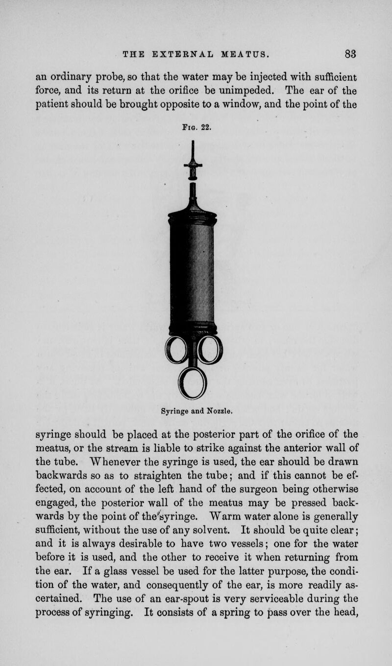 an ordinary probe, so that the water may be injected with sufficient force, and its return at the orifice be unimpeded. The ear of the patient should be brought opposite to a window, and the point of the Fig. 22. Syringe and Nozzle. syringe should be placed at the posterior part of the orifice of the meatus, or the stream is liable to strike against the anterior wall of the tube. Whenever the syringe is used, the ear should be drawn backwards so as to straighten the tube; and if this cannot be ef- fected, on account of the left hand of the surgeon being otherwise engaged, the posterior wall of the meatus may be pressed back- wards by the point of theVyringe. Warm water alone is generally sufficient, without the use of any solvent. It should be quite clear; and it is always desirable to have two vessels; one for the water before it is used, and the other to receive it when returning from the ear. If a glass vessel be used for the latter purpose, the condi- tion of the water, and consequently of the ear, is more readily as- certained. The use of an ear-spout is very serviceable during the process of syringing. It consists of a spring to pass over the head,