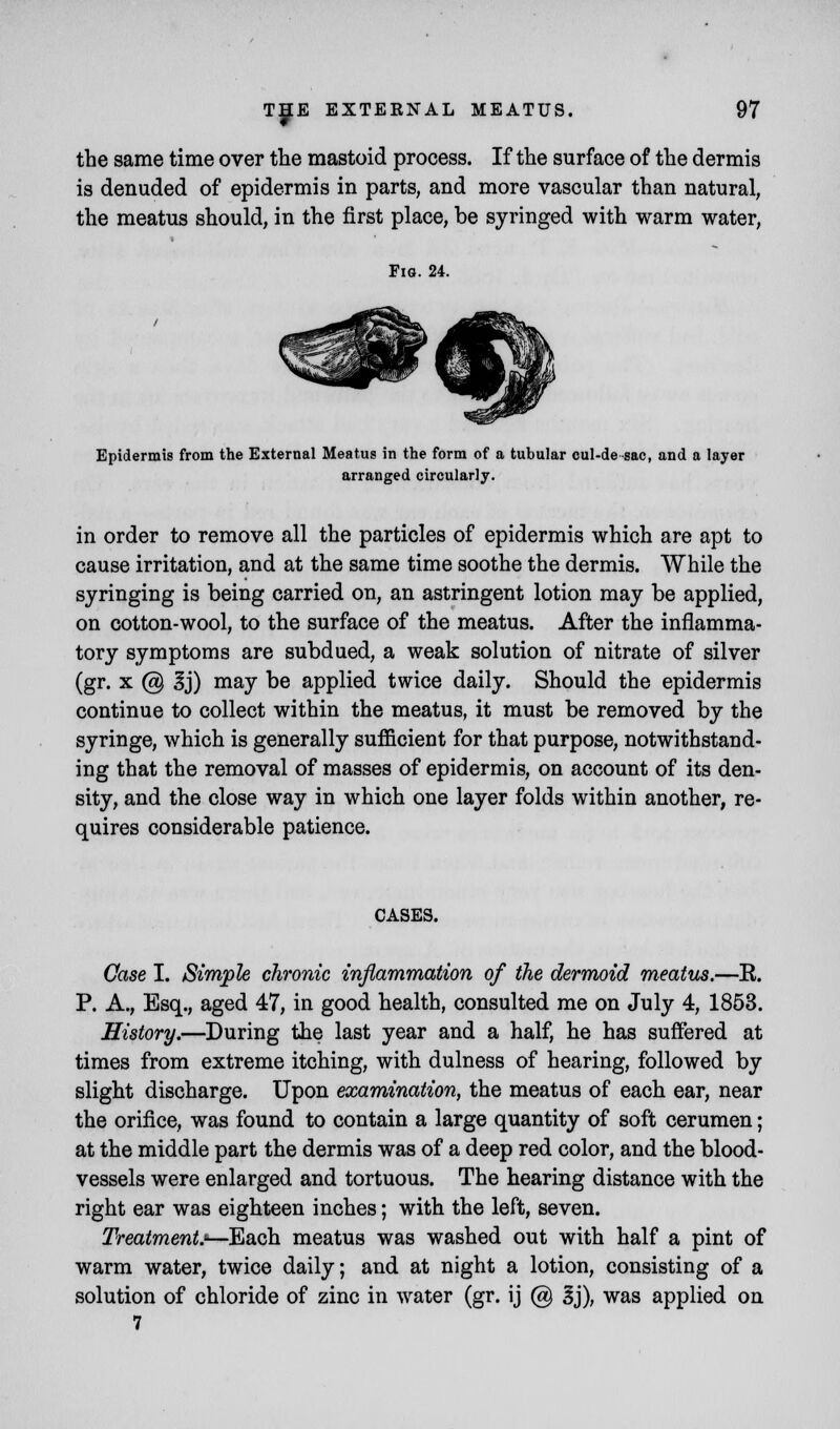 the same time over the mastoid process. If the surface of the dermis is denuded of epidermis in parts, and more vascular than natural, the meatus should, in the first place, be syringed with warm water, Fig. 24. Epidermis from the External Meatus in the form of a tubular cul-de sac, and a layer arranged circularly. in order to remove all the particles of epidermis which are apt to cause irritation, and at the same time soothe the dermis. While the syringing is being carried on, an astringent lotion may be applied, on cotton-wool, to the surface of the meatus. After the inflamma- tory symptoms are subdued, a weak solution of nitrate of silver (gr. x @ 3j) may be applied twice daily. Should the epidermis continue to collect within the meatus, it must be removed by the syringe, which is generally sufficient for that purpose, notwithstand- ing that the removal of masses of epidermis, on account of its den- sity, and the close way in which one layer folds within another, re- quires considerable patience. CASES. Case I. Simple chronic inflammation of the dermoid meatus.—E. P. A., Esq., aged 47, in good health, consulted me on July 4, 1853. History.—During the last year and a half, he has suffered at times from extreme itching, with dulness of hearing, followed by slight discharge. Upon examination, the meatus of each ear, near the orifice, was found to contain a large quantity of soft cerumen; at the middle part the dermis was of a deep red color, and the blood- vessels were enlarged and tortuous. The hearing distance with the right ear was eighteen inches; with the left, seven. Treatments—Each meatus was washed out with half a pint of warm water, twice daily; and at night a lotion, consisting of a solution of chloride of zinc in water (gr. ij @ 3j), was applied on 7