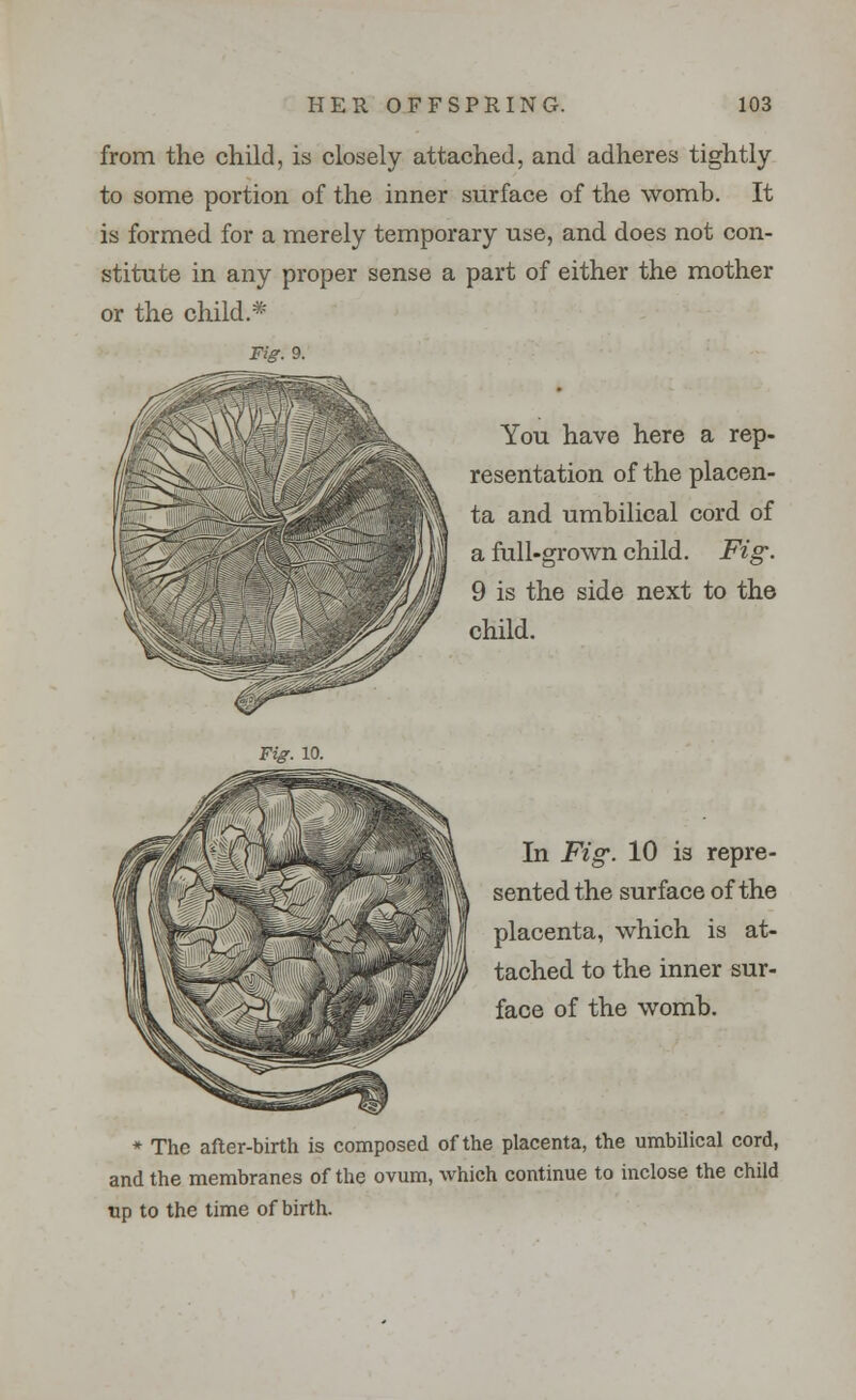 from the child, is closely attached, and adheres tightly to some portion of the inner surface of the womb. It is formed for a merely temporary use, and does not con- stitute in any proper sense a part of either the mother or the child.* Fig. 9. You have here a rep- resentation of the placen- ta and umbilical cord of a full-grown child. Fig. 9 is the side next to the child. Fig. 10. In Fig. 10 is repre- sented the surface of the placenta, which is at- tached to the inner sur- face of the womb. * The after-birth is composed of the placenta, the umbilical cord, and the membranes of the ovum, which continue to inclose the child up to the time of birth.