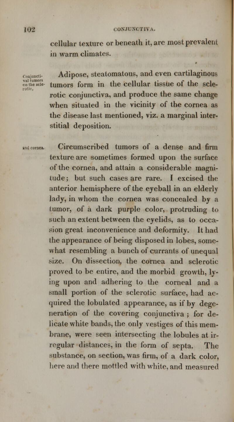 cellular texture or beneath it, are most prevalent in warm climates. cornea- Adipose, steatomatous, and even cartilaginous onthTscil tumors form in the cellular tissue of the scle- rotic, rotic conjunctiva, and produce the same change when situated in the vicinity of the cornea as the disease last mentioned, viz. a marginal inter- stitial deposition. and coma. Circumscribed tumors of a dense and firm texture are sometimes formed upon the surface of the cornea, and attain a considerable magni- tude ; but such cases are rare. I excised the anterior hemisphere of the eyeball in an elderly lady, in whom the cornea was concealed by a tumor, of a dark purple color, protruding to such an extent between the eyelids, as to occa- sion great inconvenience and deformity. It had the appearance of being disposed in lobes, some- what resembling a bunch of currants of unequal size. On dissection, the cornea and sclerotic proved to be entire, and the morbid growth, ly- ing upon and adhering to the corneal and a small portion of the sclerotic surface, had ac- quired the lobulated appearance, as if by dege- neration of the covering conjunctiva ; for de- licate white bands, the only vestiges of this mem- brane, were seen intersecting the lobules at ir- regular distances, in the form of septa. The substance, on section, was firm, of a dark color, here and there mottled with white, and measured