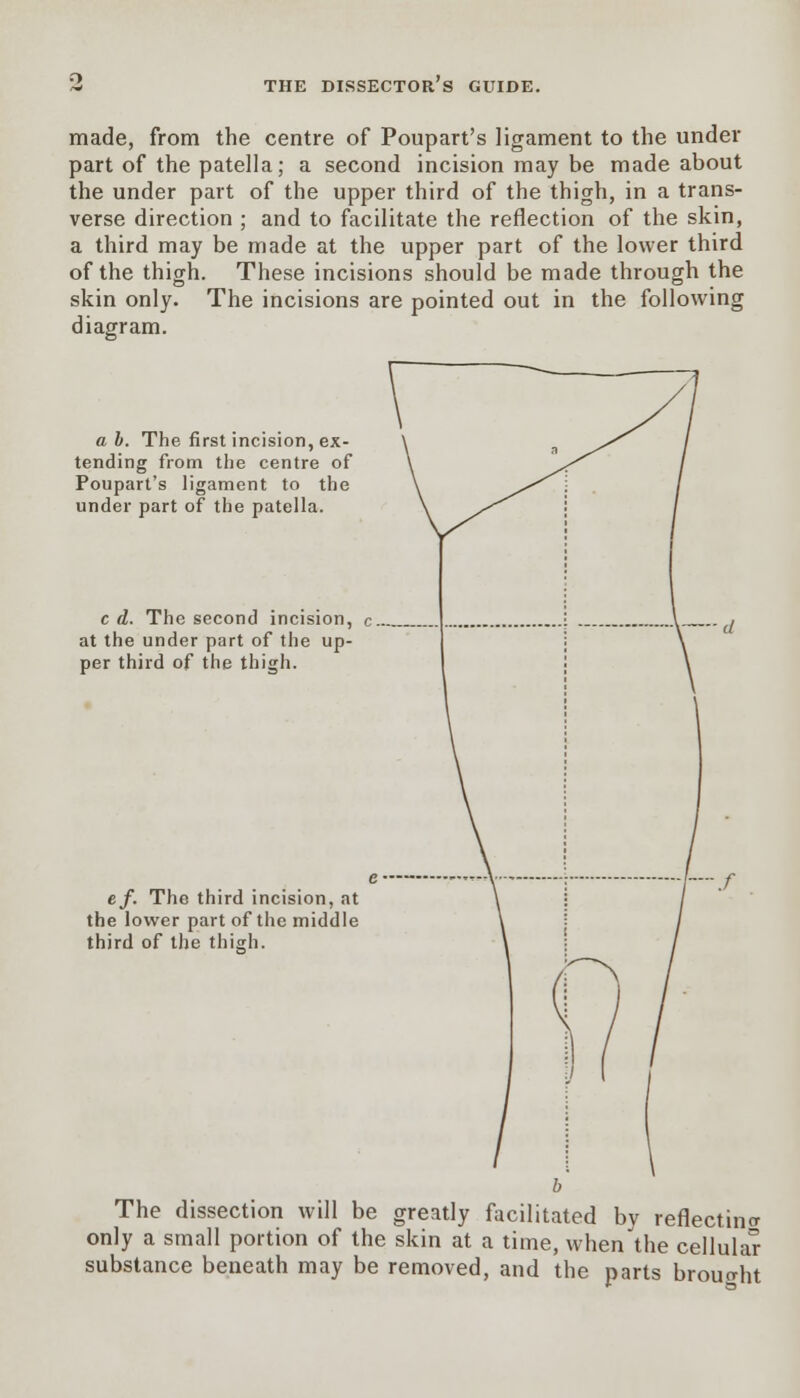 made, from the centre of Poupart's ligament to the under part of the patella; a second incision may be made about the under part of the upper third of the thigh, in a trans- verse direction ; and to facilitate the reflection of the skin, a third may be made at the upper part of the lower third of the thigh. These incisions should be made through the skin only. The incisions are pointed out in the following diagram. ah. The first incision, ex- tending from the centre of Poupart's ligament to the under part of the patella. c d. The second incision, c at the under part of the up- per third of the thigh. ef. The third incision, at the lower part of the middle third of the thigh. The dissection will be greatly facilitated by reflectino- only a small portion of the skin at a time, when'the cellular substance beneath may be removed, and the parts brouo-ht