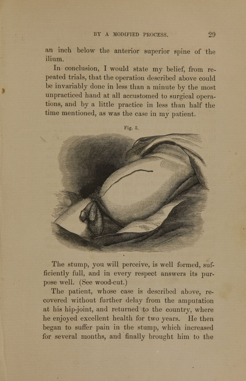 an inch below the anterior superior spine of the ilium. In conclusion, I would state my belief, from re- peated trials, that the operation described above could be invariably done in less than a minute by the most unpracticed hand at all accustomed to surgical opera- tions, and by a little practice in less than half the time mentioned, as was the case in my patient. Fig. 3. The stump, you will perceive, is well formed, suf- ficiently full, and in every respect answers its pur- pose well. (See wood-cut.) The patient, whose case is described above, re- covered without further delay from the amputation at his hip-joint, and returned to the country, where he enjoyed excellent health for two years. He then began to suffer pain in the stump, which increased for several months, and finally brought him to the