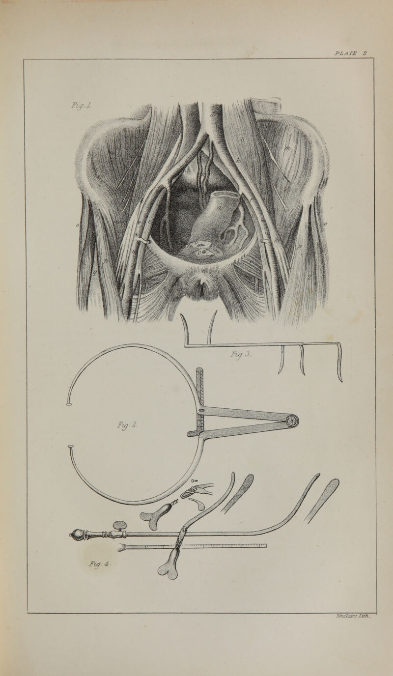 I3 LATE 2 Sinclair.* Liih..