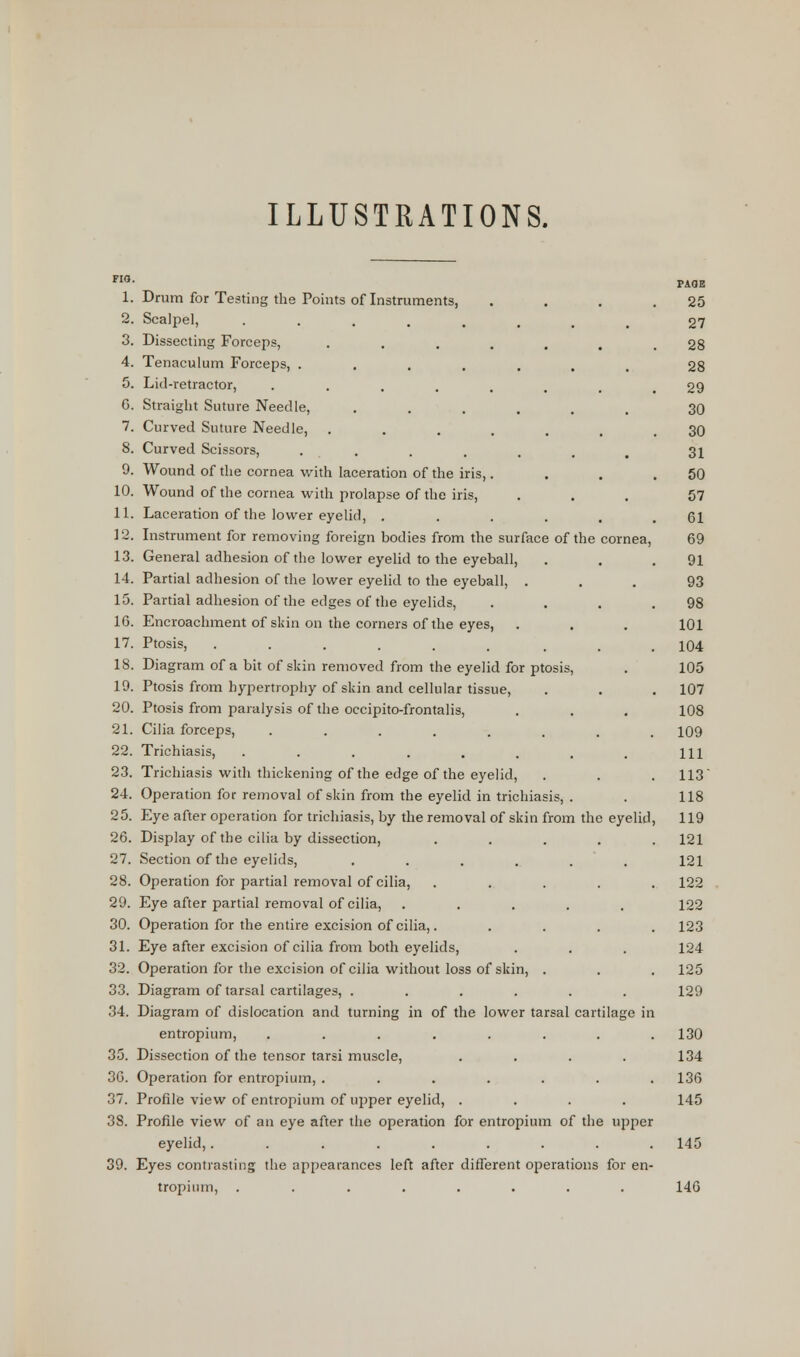 ILLUSTRATIONS. FW- PAGE 1. Drum for Testing the Points of Instruments, . . . .25 2. Scalpel, ....... 27 3. Dissecting Forceps, ..... 28 4. Tenaculum Forceps, ....... 28 5. Lid-retractor, ....... 29 6. Straight Suture Needle, ...... 30 7. Curved Suture Needle, ....... 30 8. Curved Scissors, . . . . . . # 21 9. Wound of the cornea with laceration of the iris,. . . .50 10. Wound of the cornea with prolapse of the iris, ... 57 11. Laceration of the lower eyelid, ...... 61 12. Instrument for removing foreign bodies from the surface of the cornea, 69 13. General adhesion of the lower eyelid to the eyeball, . . .91 14. Partial adhesion of the lower eyelid to the eyeball, ... 93 15. Partial adhesion of the edges of the eyelids, . . . .98 16. Encroachment of skin on the corners of the eyes, . . . 101 17. Ptosis, ...... ... 104 18. Diagram of a bit of skin removed from the eyelid for ptosis, . 105 19. Ptosis from hypertrophy of skin and cellular tissue, . . . 107 20. Ptosis from paralysis of the occipito-frontalis, . . . 108 21. Cilia forceps, ........ 109 22. Trichiasis, . . . . . . . . m 23. Trichiasis with thickening of the edge of the eyelid, . . . 113' 24. Operation for removal of skin from the eyelid in trichiasis, . . 118 25. Eye after operation for trichiasis, by the removal of skin from the eyelid, 119 26. Display of the cilia by dissection, ..... 121 27. Section of the eyelids, ...... 121 28. Operation for partial removal of cilia, ...... 122 29. Eye after partial removal of cilia, ..... 122 30. Operation for the entire excision of cilia,. .... 123 31. Eye after excision of cilia from both eyelids, . . . 124 32. Operation for the excision of cilia without loss of skin, . . . 125 33. Diagram of tarsal cartilages, ...... 129 34. Diagram of dislocation and turning in of the lower tarsal cartilage in entropium, ........ 130 35. Dissection of the tensor tarsi muscle, .... 134 36. Operation for entropium, ....... 136 37. Profile view of entropium of upper eyelid, .... 145 3S. Profile view of an eye after the operation for entropium of the upper eyelid,......... 145 39. Eyes contrasting the appearances left after different operations for en- tropium, ........ 146