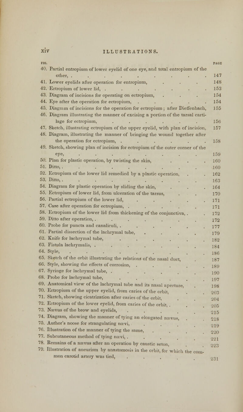 FIG. 40. 41. 42. 43. 44. 45. 46. 47. 48. 49. 50. 51. 52. 53. 54. 55. 56. 57. 58. 59. 60. 61. 62. 63. 64. 65. 66. 67. 68. 69. 70. 71. 72. 73. 74. 75. 76. 77. 78. 79. Partial entropium of lower eyelid of one eye, and total entropium of the other, ......... Lower eyelids after operation for entropium, Ectropium of lower lid, ....... Diagram of incisions for operating on ectropium, Eye after the operation for ectropium, ..... Diagram of incisions for the operation for ectropium ; after Dieffenbach, Diagram illustrating the manner of excising a portion of the tarsal carti- lage for ectropium, ...... Sketch, illustrating ectropium of the upper eyelid, with plan of incision, Diagram, illustrating the manner of bringing the wound together after the operation for ectropium, ...... Sketch, showing plan of incision for ectropium of the outer corner of the eye, ....... Plan for plastic operation, by twisting the skin, Ditto, ........ Ectropium of the lower lid remedied by a plastic operation, Ditto, ........ Diagram for plastic operation by sliding the skin, Ectropium of lower lid, from ulceration of the tarsus, Partial ectropium of the lower lid, Case after operation for ectropium, .... Ectropium of the lower lid from thickening of the conjunctiva, Ditto after operation, ...... Probe for puncta and canaliculi, .... Partial dissection of the lachrymal tube, Knife for lachrymal tube, .... Fistula lachrymalis, ..... Style, Sketch of the orbit illustrating the relations of the nasal duct Style, showing the effects of corrosion, . Syringe for lachrymal tube, .... Probe for lachrymal tube, Anatomical view of the lachrymal tube and its nasal aperture, Ectropium of the upper eyelid, from caries of the orbit, Sketch, showing cicatrization after caries of the orbit Ectropium of the lower eyelid, from caries of the orbit, . Neevus of the brow and eyelids, Diagram, showing the manner of tying an elongated nsevus, Author's noose for strangulating na\'vi, Illustration of the manner of tying the same, Subcutaneous method of tying navi, . Remains of a naevus after an operation by caustic seton Illustration of aneurism by anastomosis in the orbit, for which the com- mon carotid artery was tied, PAGE 147 148 153 154 154 155 156 157 IDS 159 160 160 162 163 164 170 171 171 172 172 177 179 182 184 186 187 189 190 197 198 203 204 205 215 218 219 220 221 223 231