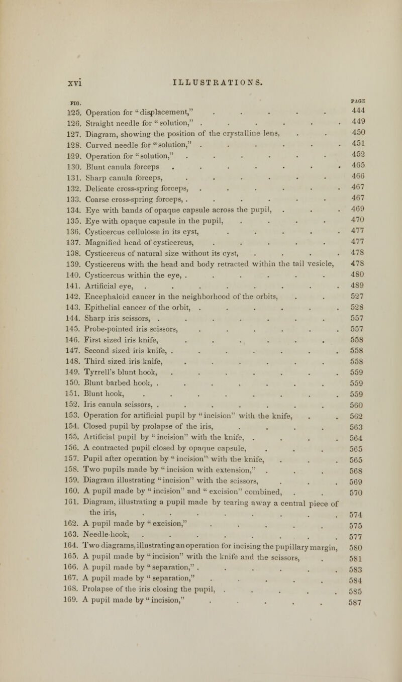 FIG. 125. Operation for  displacement, 126. Straight needle for  solution, . 127. Diagram, showing the position of the crystalline lens, 128. Curved needle for solution, . 129. Operation for  solution, .... 130. Blunt canula forceps .... 131. Sharp canula forceps, .... 132. Delicate cross-spring forceps, 133. Coarse cross-spring forceps, .... 134. Eye with bands of opaque capsule across the pupil, 135. Eye with opaque capsule in the pupil, 136. Cysticercus cellulosse in its cyst, 137. Magnified head of cysticercus, 138. Cysticercus of natural size without its cyst, 139. Cysticercus with the head and body retracted within the tail vesic 140. Cysticercus within the eye, . 141. Artificial eye, 142. Encephaloid cancer in the neighborhood of the orbits, 143. Epithelial cancer of the orbit, . 144. Sharp iris scissors, . 145. Probe-pointed iris scissors, 146. First sized iris knife, 147. Second sized iris knife, . 148. Third sized iris knife, 149. Tyrrell's blunt hook, 150. Blunt barbed hook, . 151. Blunt hook, 152. Iris canula scissors, ..... 153. Operation for artificial pupil by incision with the knife, 154. Closed pupil by prolapse of the iris, 155. Artificial pupil by incision with the knife, . 156. A contracted pupil closed by opaque capsule, 157. Pupil after operation by  incision with the knife, 158. Two pupils made by  incision with extension, 159. Diagram illustrating incision with the scissors, 160. A pupil made by  incision and  excision combined, 161. Diagram, illustrating a pupil made by tearing away a central piece of the iris, ••-... 102. A pupil made by  excision, . 163. Needle-hook, ....... 164. Two diagrams, illustrating an operation for incising the pupillary margin, 165. A pupil made by incision with the knife and the scissors, 166. A pupil made by separation, .... 167. A pupil made by  separation, .... 168. Prolapse of the iris closing the pupil, . 169. A pupil made by  incision, . PAGE 444 449 450 451 452 465 466 467 467 469 470 477 477 478 478 480 489 527 528 557 557 558 558 558 559 559 559 560 562 563 564 565 565 568 509 570 574 575 577 5S0 5S1 5S3 584 5S5 587